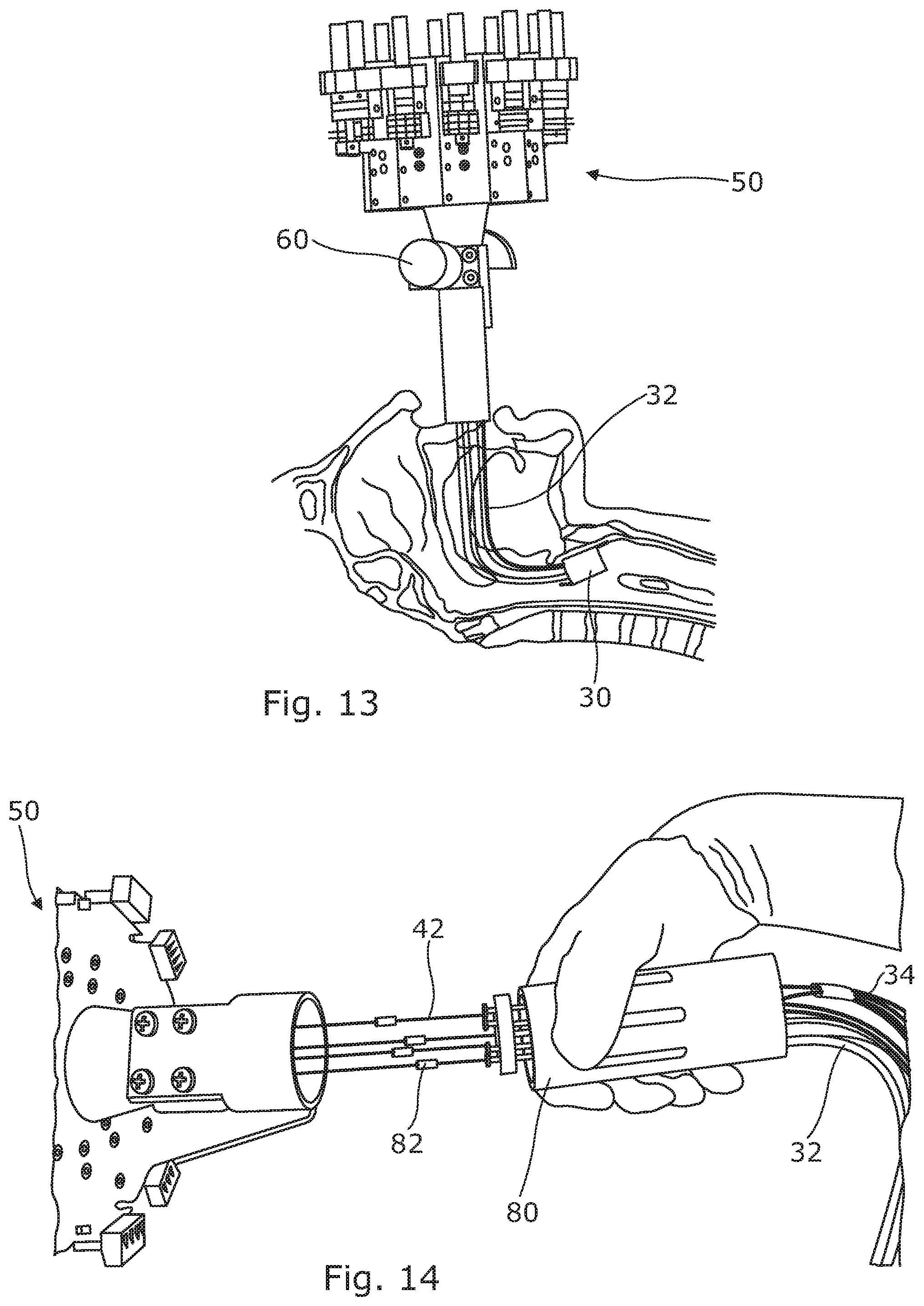 Patent US12496131 Figure 7 – Trans-oral surgery device comprising a blade with a distal scaffold and a support adjustable through tendons