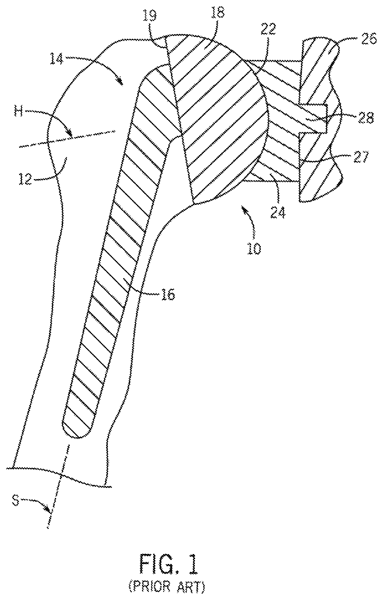 Patent US12496134 Figure 1 – Method for optimization of orthopedic component design