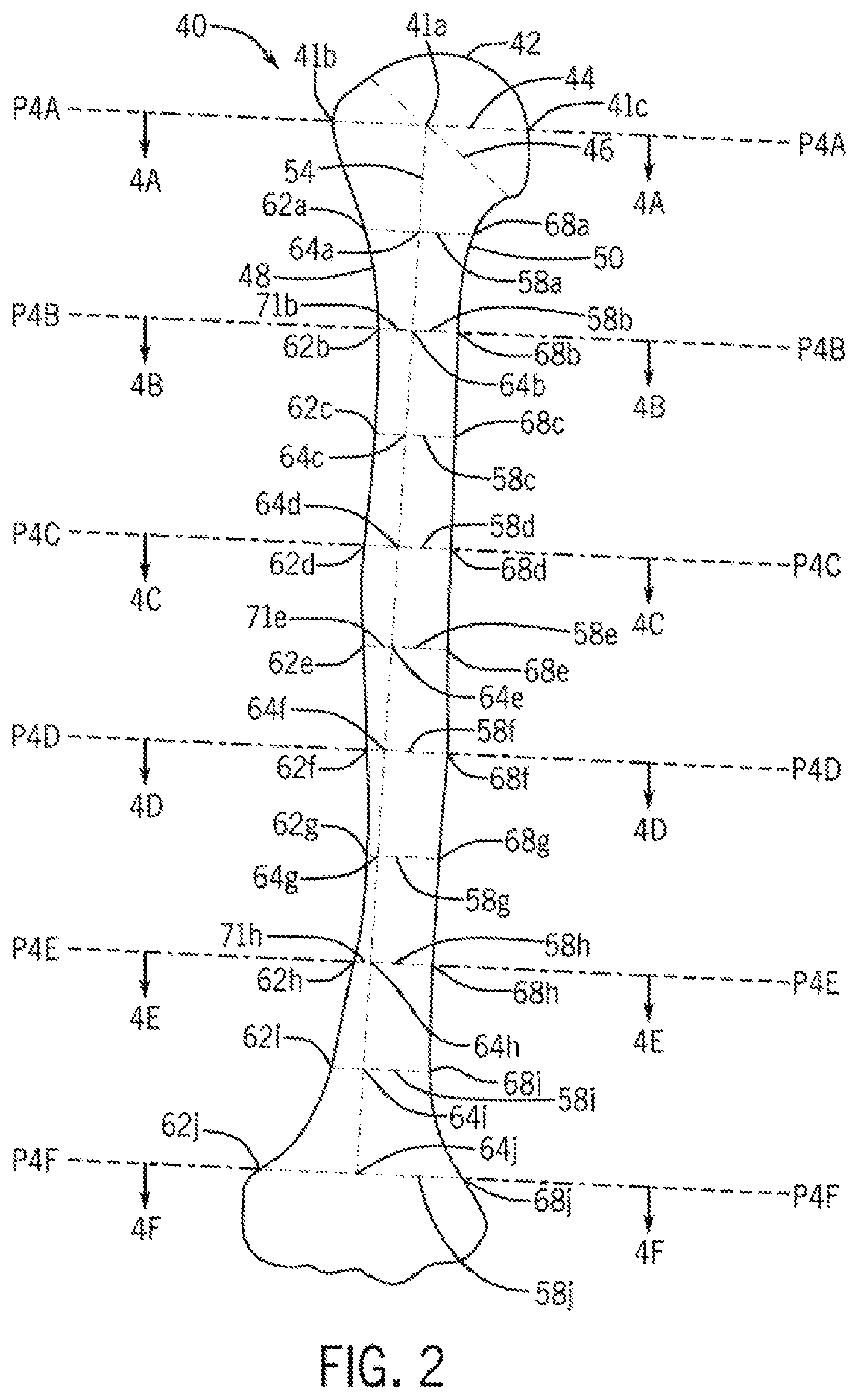 Patent US12496134 Figure 2 – Method for optimization of orthopedic component design