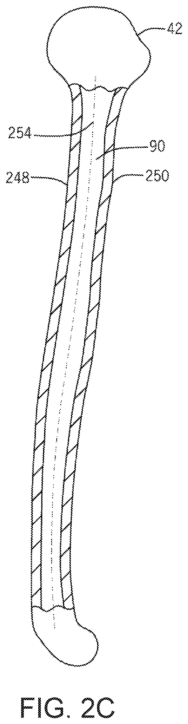 Patent US12496134 Figure 5 – Method for optimization of orthopedic component design