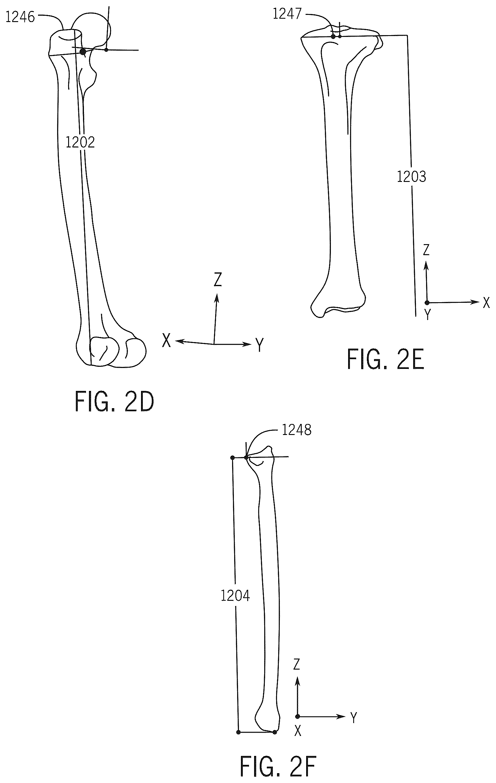 Patent US12496134 Figure 6 – Method for optimization of orthopedic component design