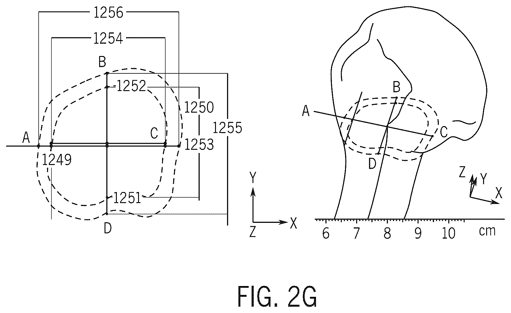 Patent US12496134 Figure 7 – Method for optimization of orthopedic component design