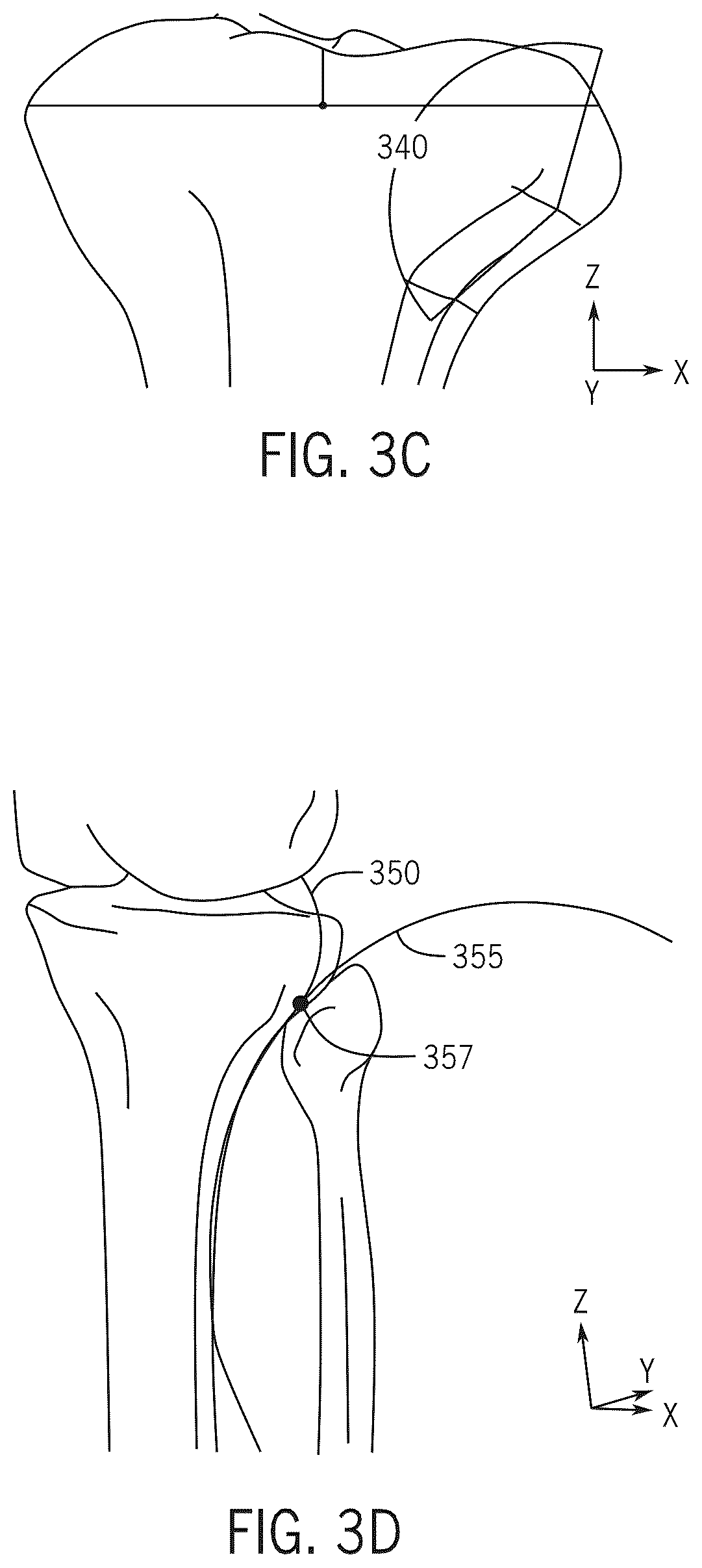 Patent US12496134 Figure 9 – Method for optimization of orthopedic component design