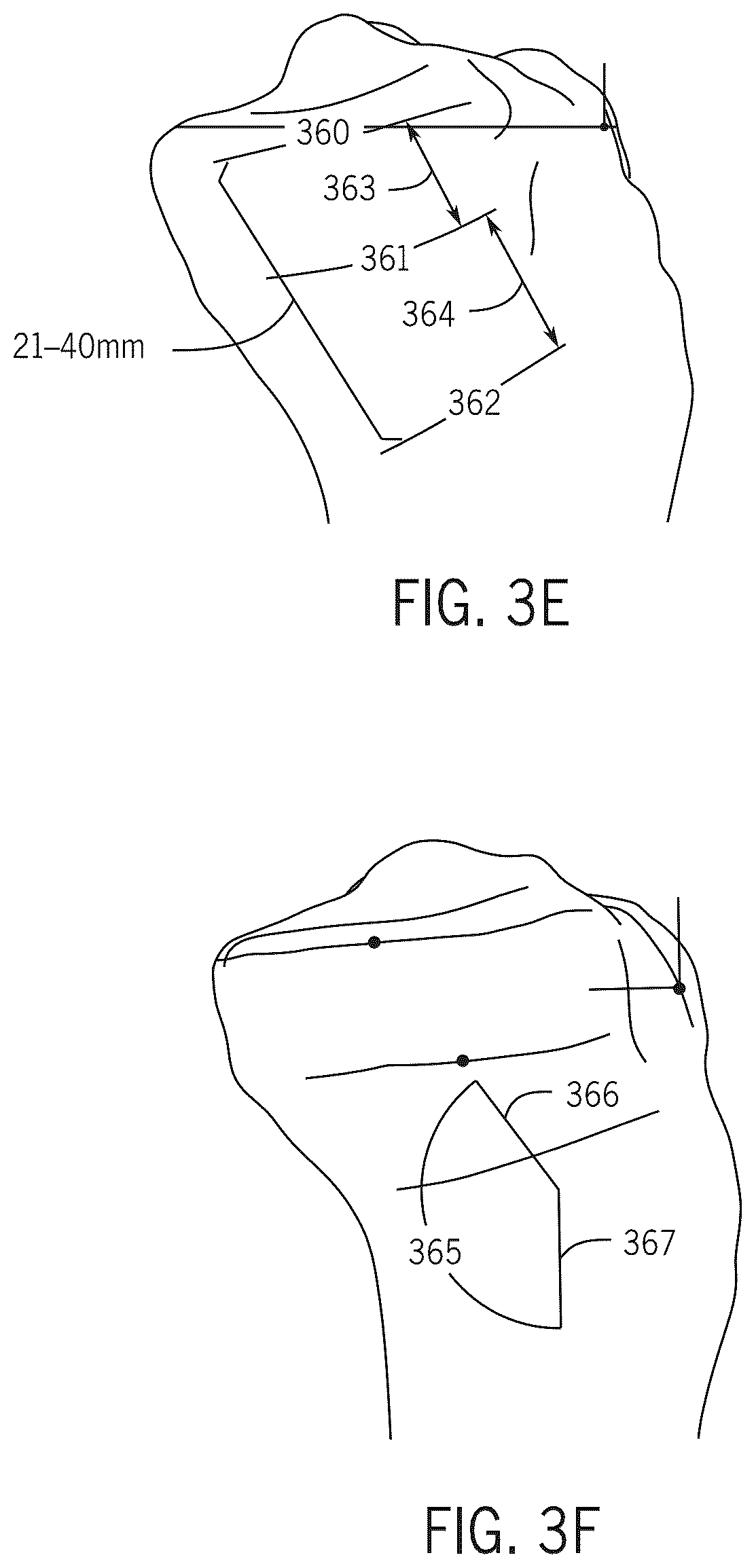 Patent US12496134 Figure 10 – Method for optimization of orthopedic component design
