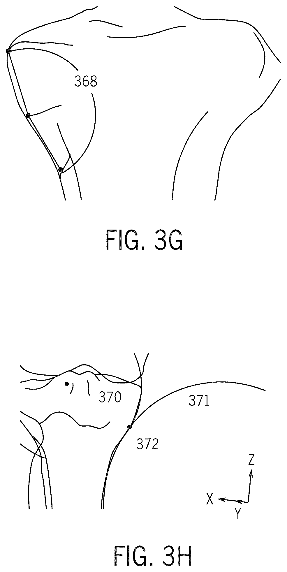 Patent US12496134 Figure 11 – Method for optimization of orthopedic component design