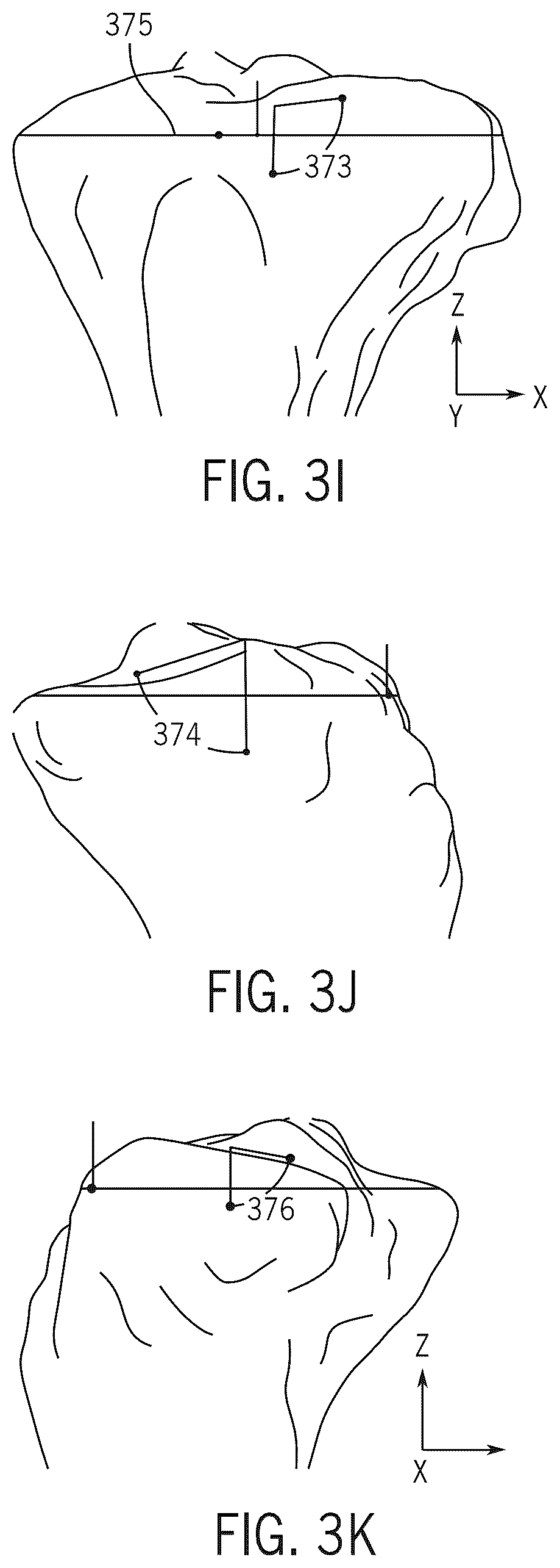 Patent US12496134 Figure 12 – Method for optimization of orthopedic component design