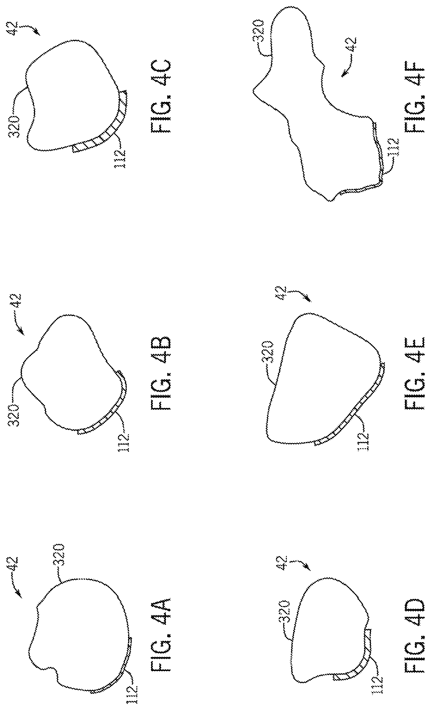 Patent US12496134 Figure 13 – Method for optimization of orthopedic component design