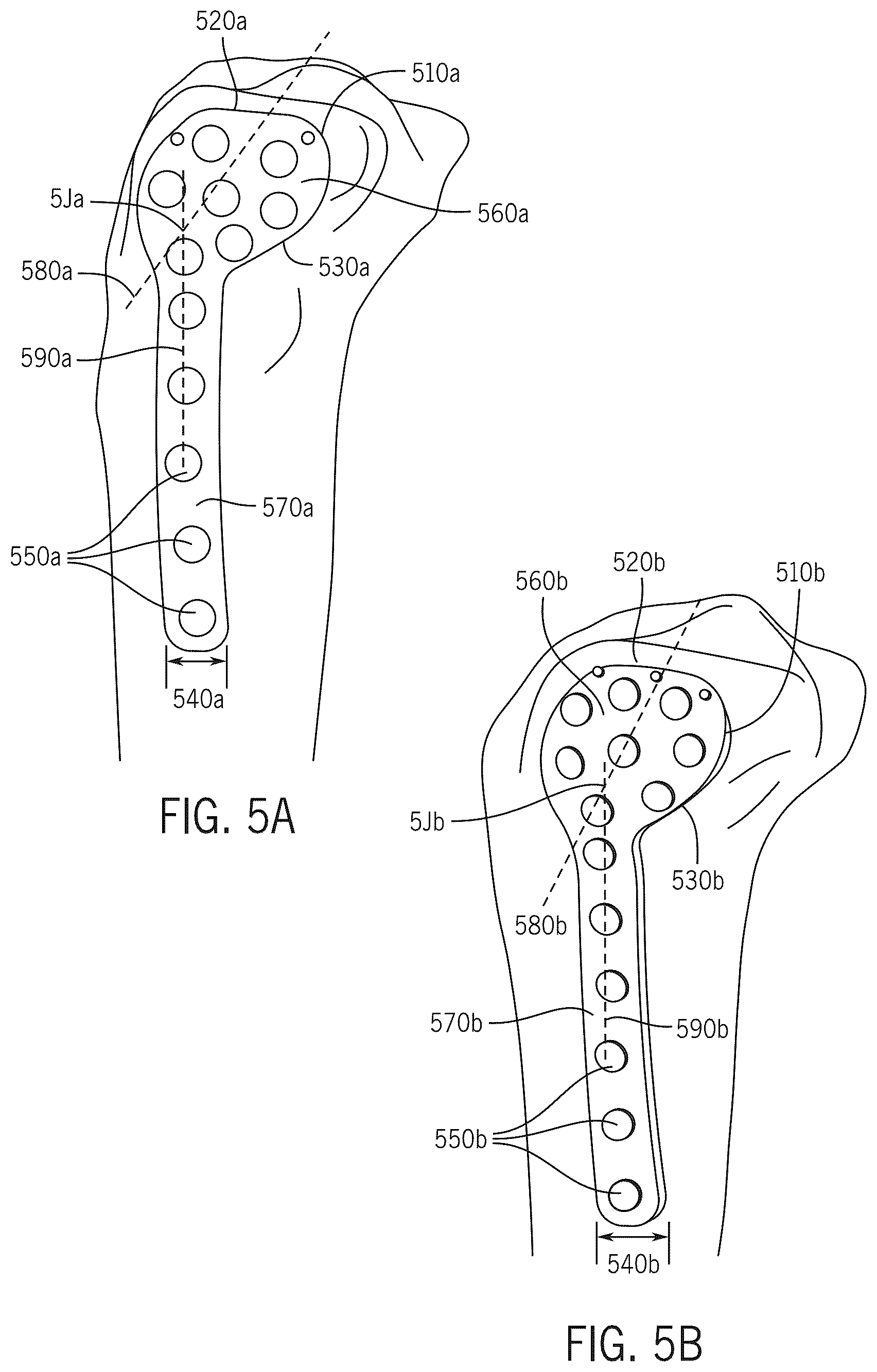 Patent US12496134 Figure 14 – Method for optimization of orthopedic component design