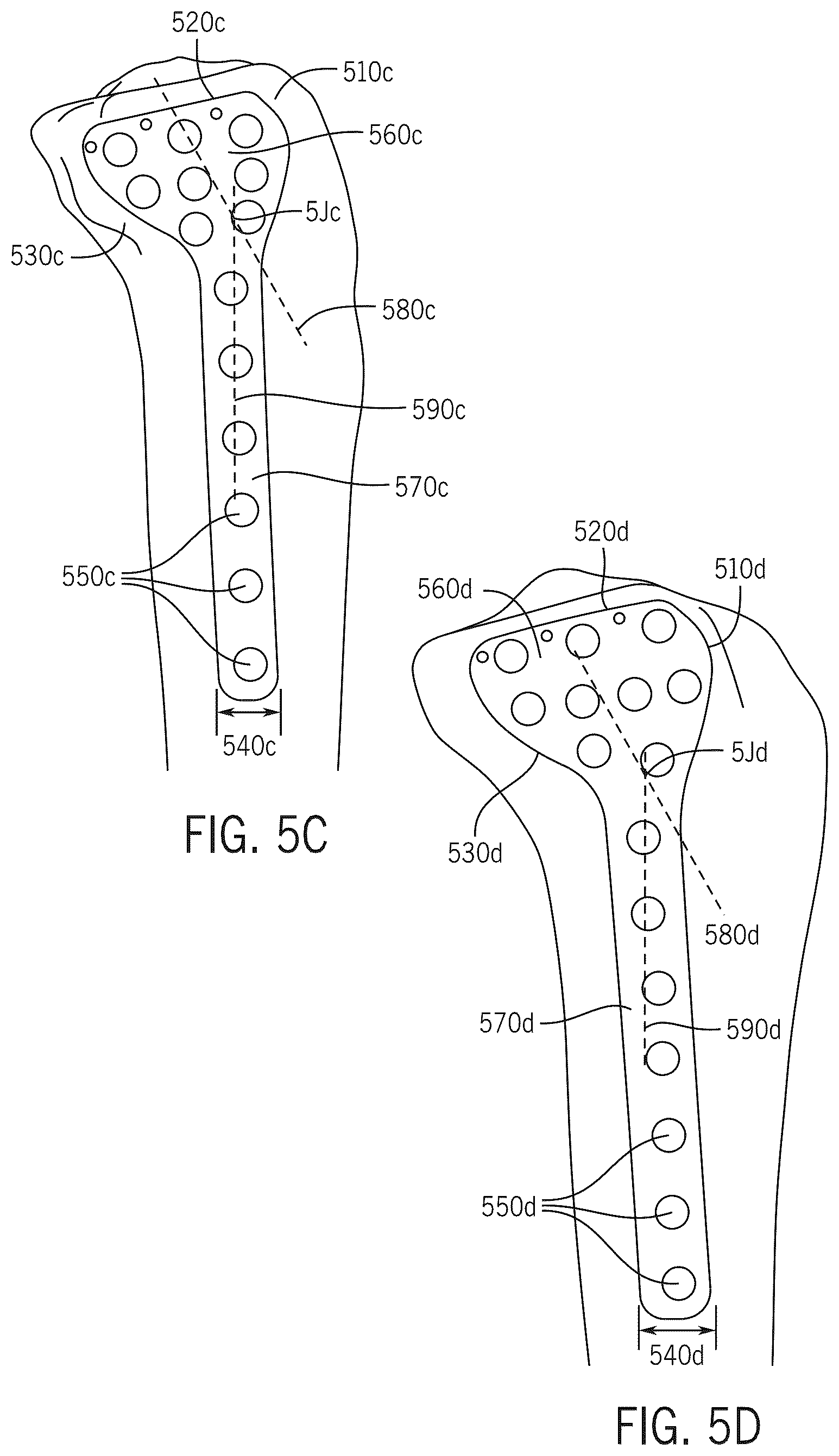 Patent US12496134 Figure 15 – Method for optimization of orthopedic component design