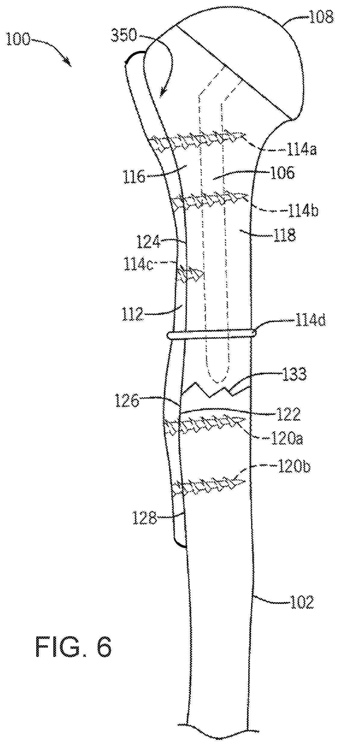 Patent US12496134 Figure 16 – Method for optimization of orthopedic component design