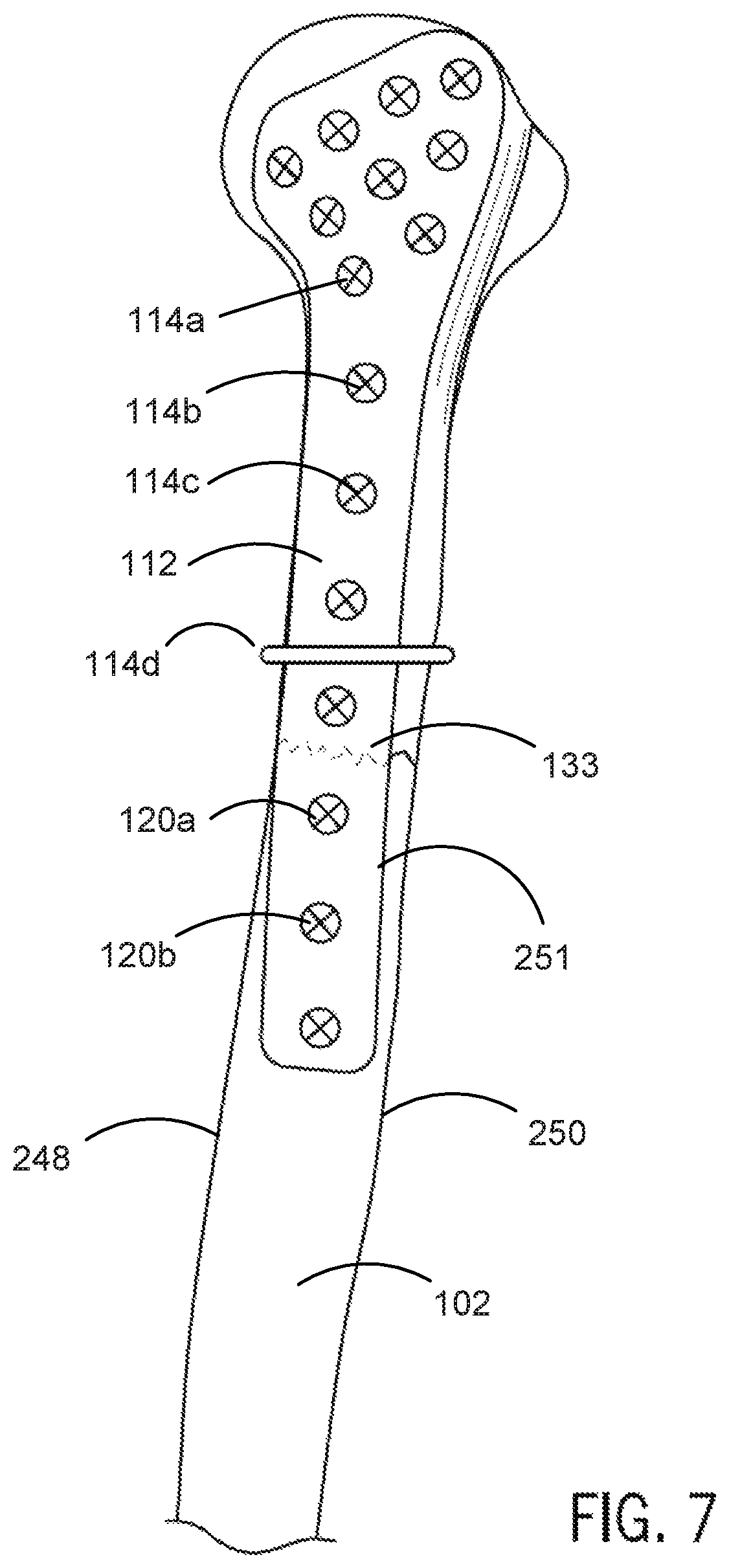 Patent US12496134 Figure 17 – Method for optimization of orthopedic component design