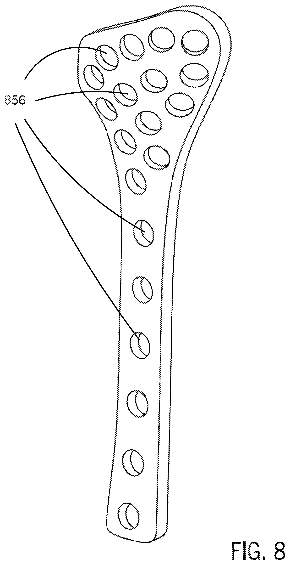 Patent US12496134 Figure 18 – Method for optimization of orthopedic component design