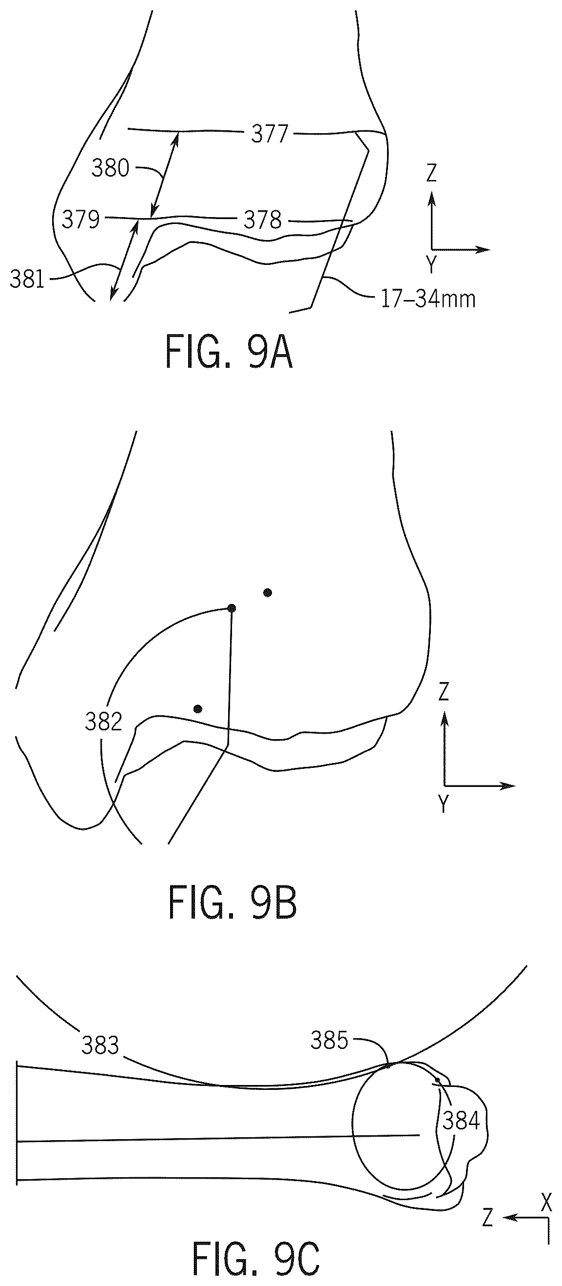 Patent US12496134 Figure 19 – Method for optimization of orthopedic component design