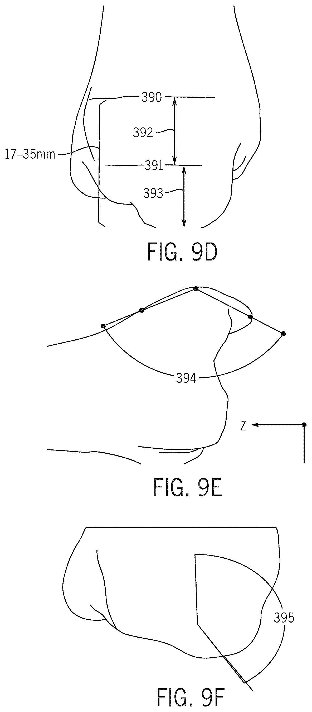 Patent US12496134 Figure 20 – Method for optimization of orthopedic component design
