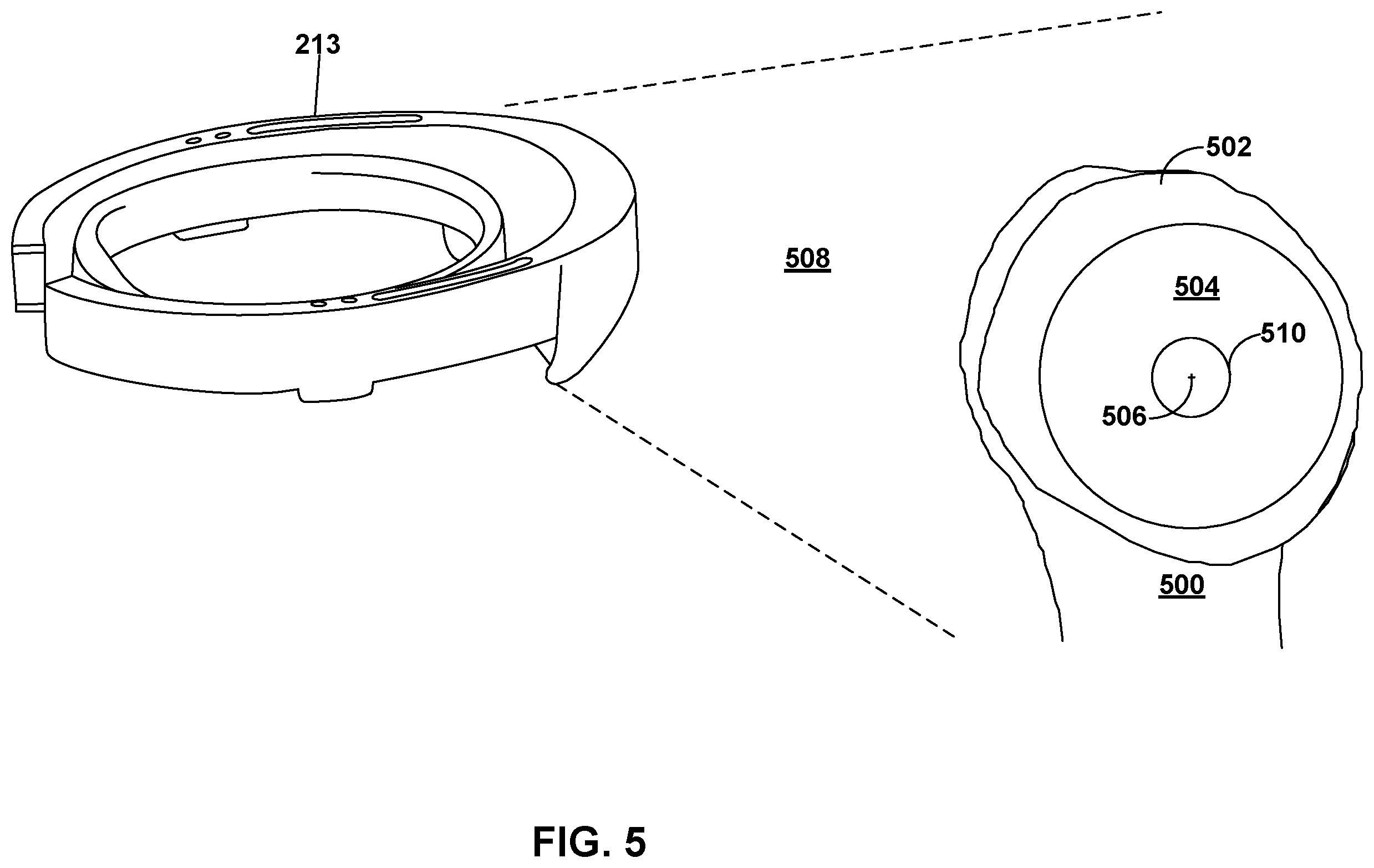 Patent US12496135 Figure 5 – Mixed-reality humeral-head sizing and placement
