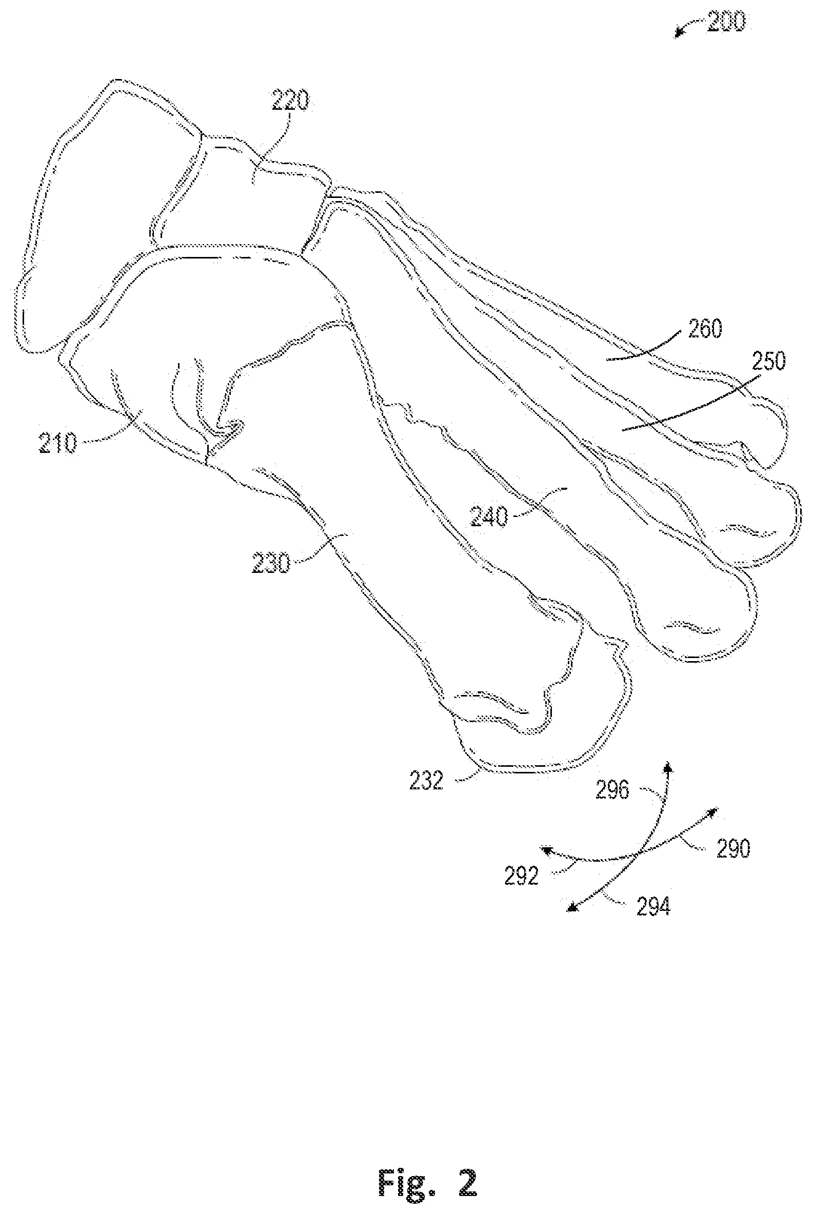 Patent US12496137 Figure 2 – Patient-specific osteotomy instrumentation