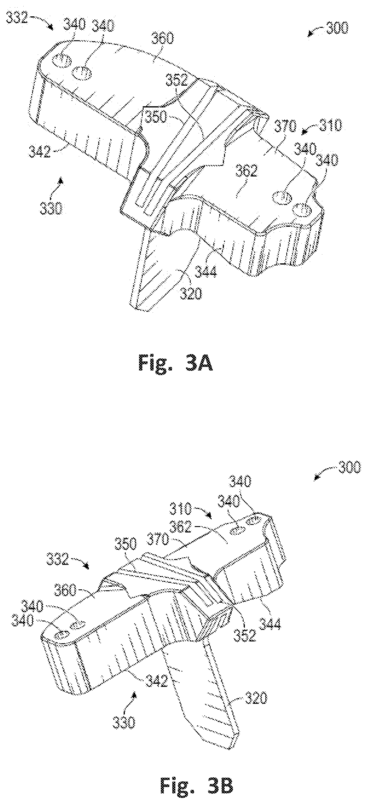 Patent US12496137 Figure 3 – Patient-specific osteotomy instrumentation