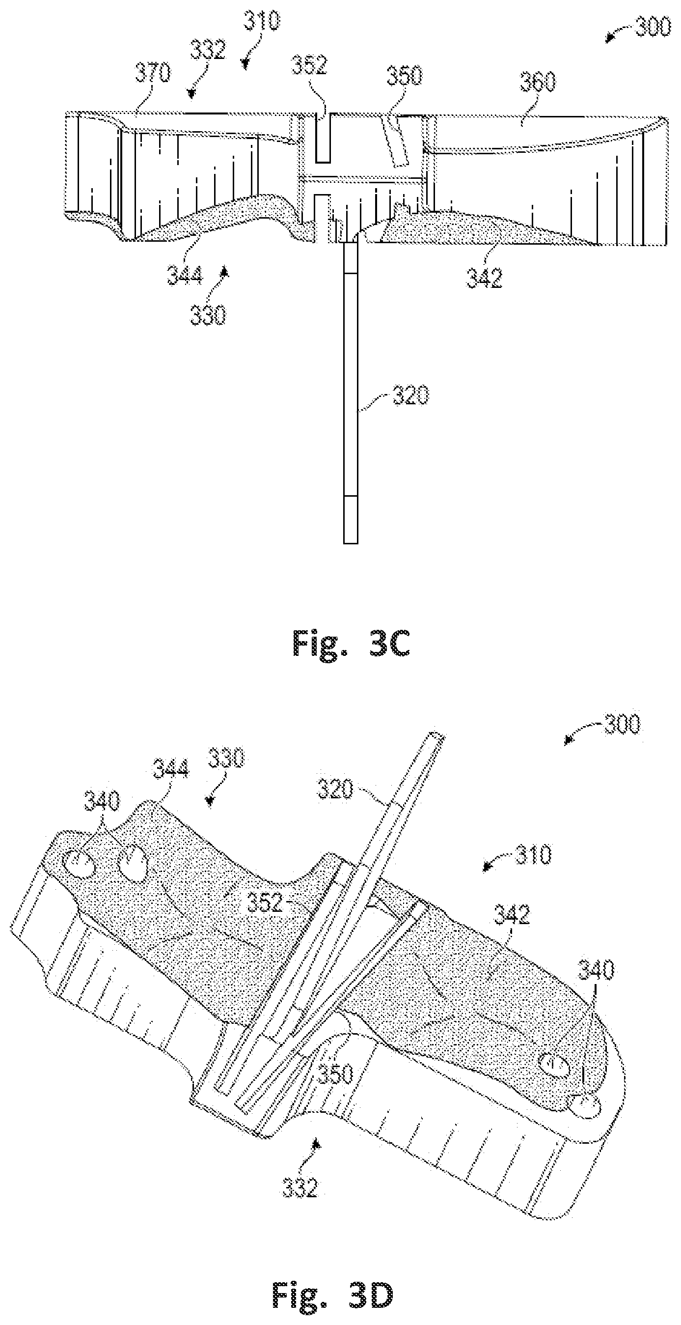 Patent US12496137 Figure 4 – Patient-specific osteotomy instrumentation