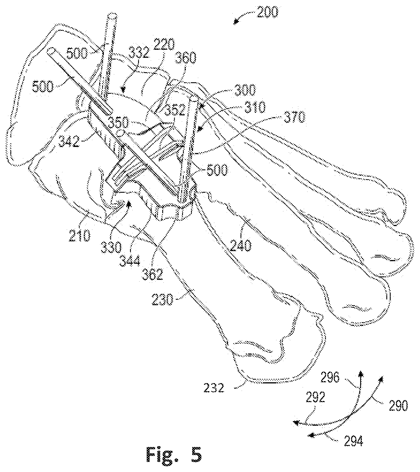 Patent US12496137 Figure 6 – Patient-specific osteotomy instrumentation