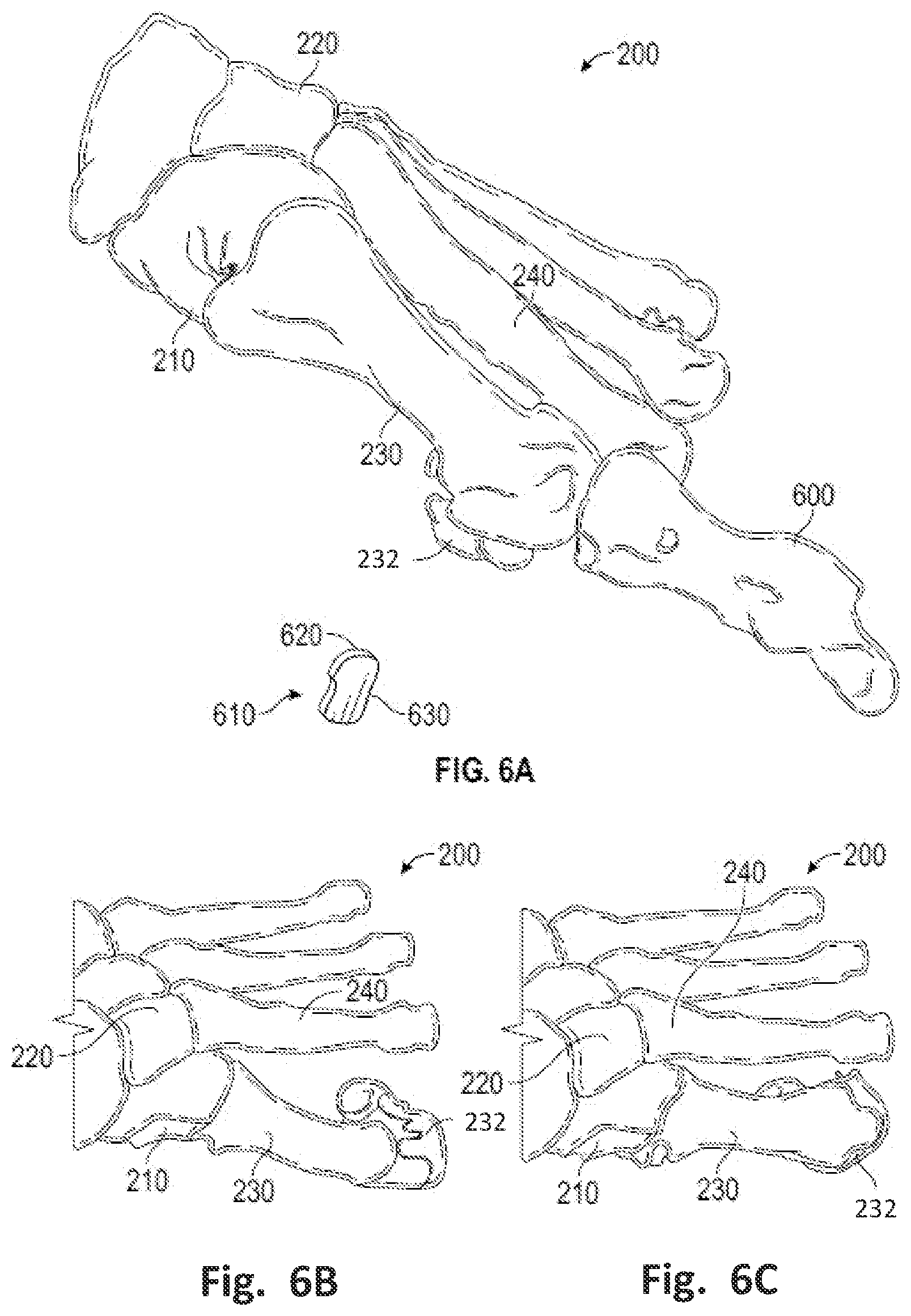 Patent US12496137 Figure 7 – Patient-specific osteotomy instrumentation