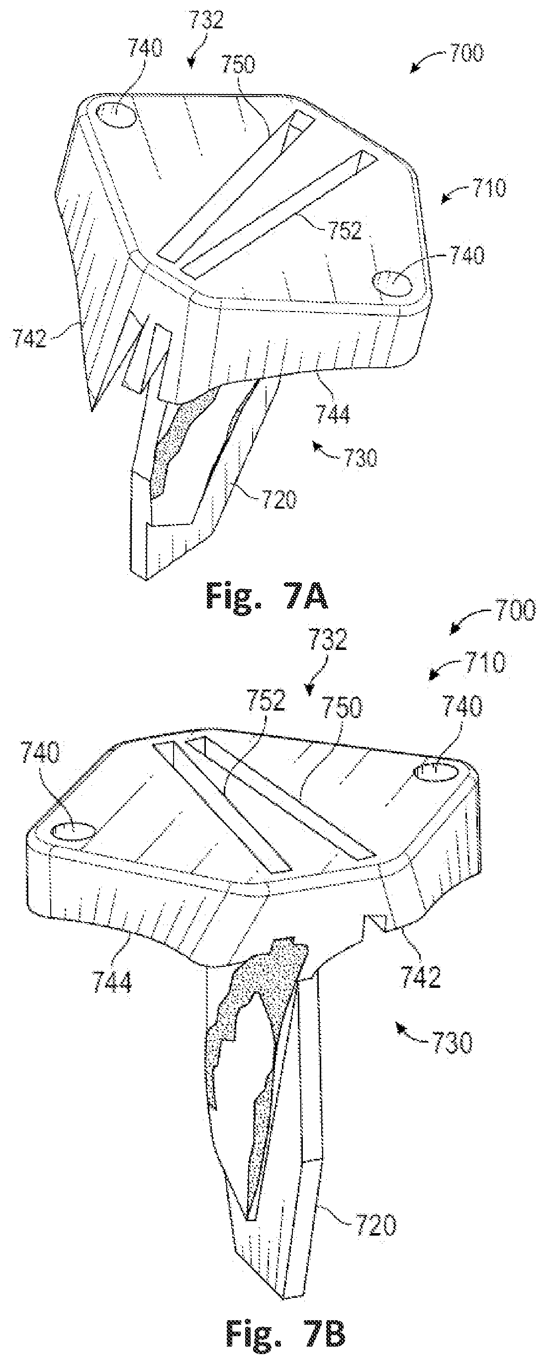 Patent US12496137 Figure 8 – Patient-specific osteotomy instrumentation