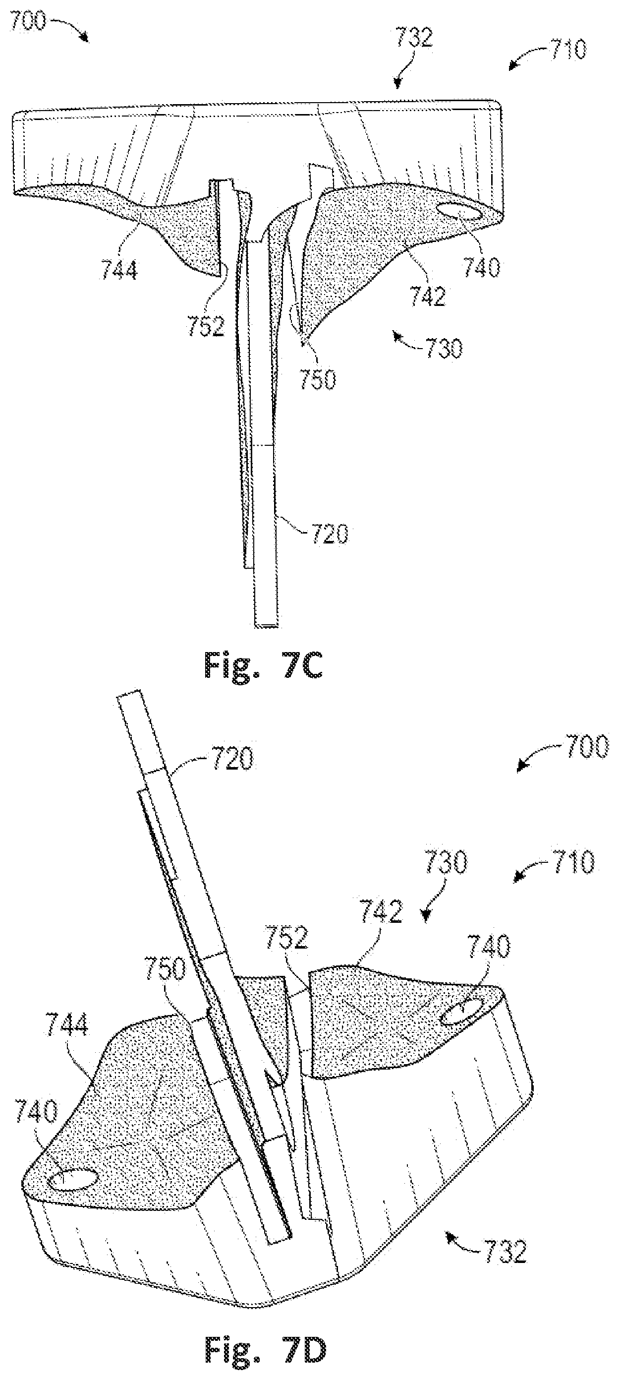 Patent US12496137 Figure 9 – Patient-specific osteotomy instrumentation
