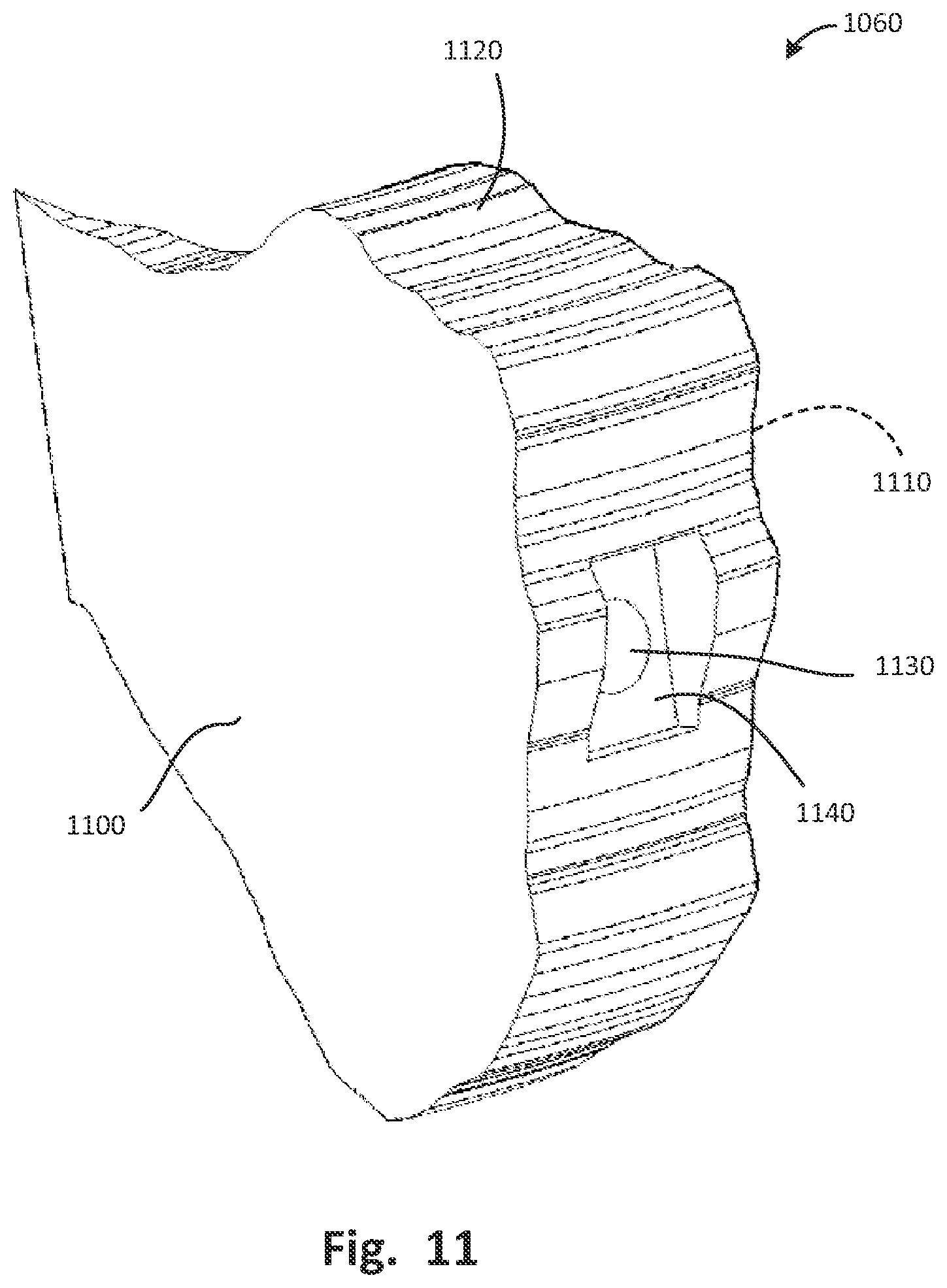 Patent US12496137 Figure 13 – Patient-specific osteotomy instrumentation