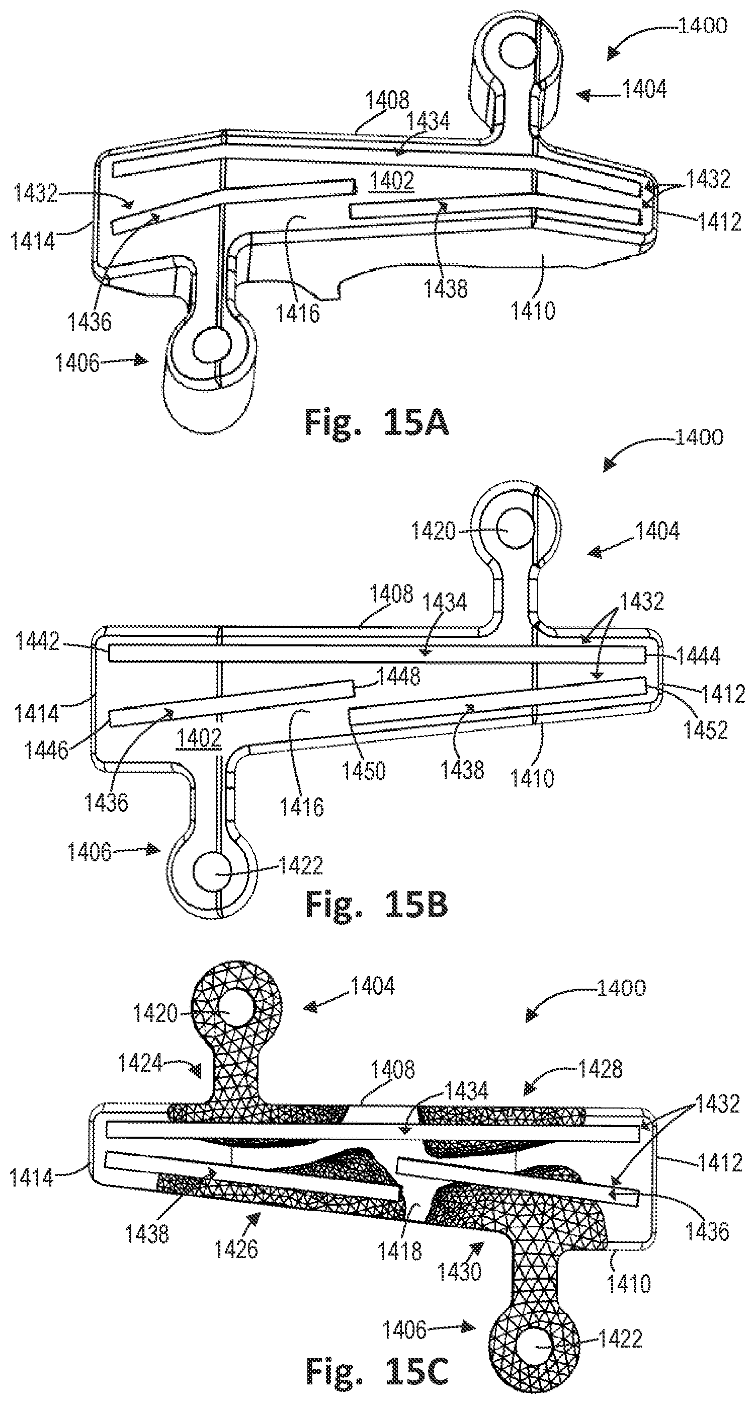 Patent US12496137 Figure 17 – Patient-specific osteotomy instrumentation