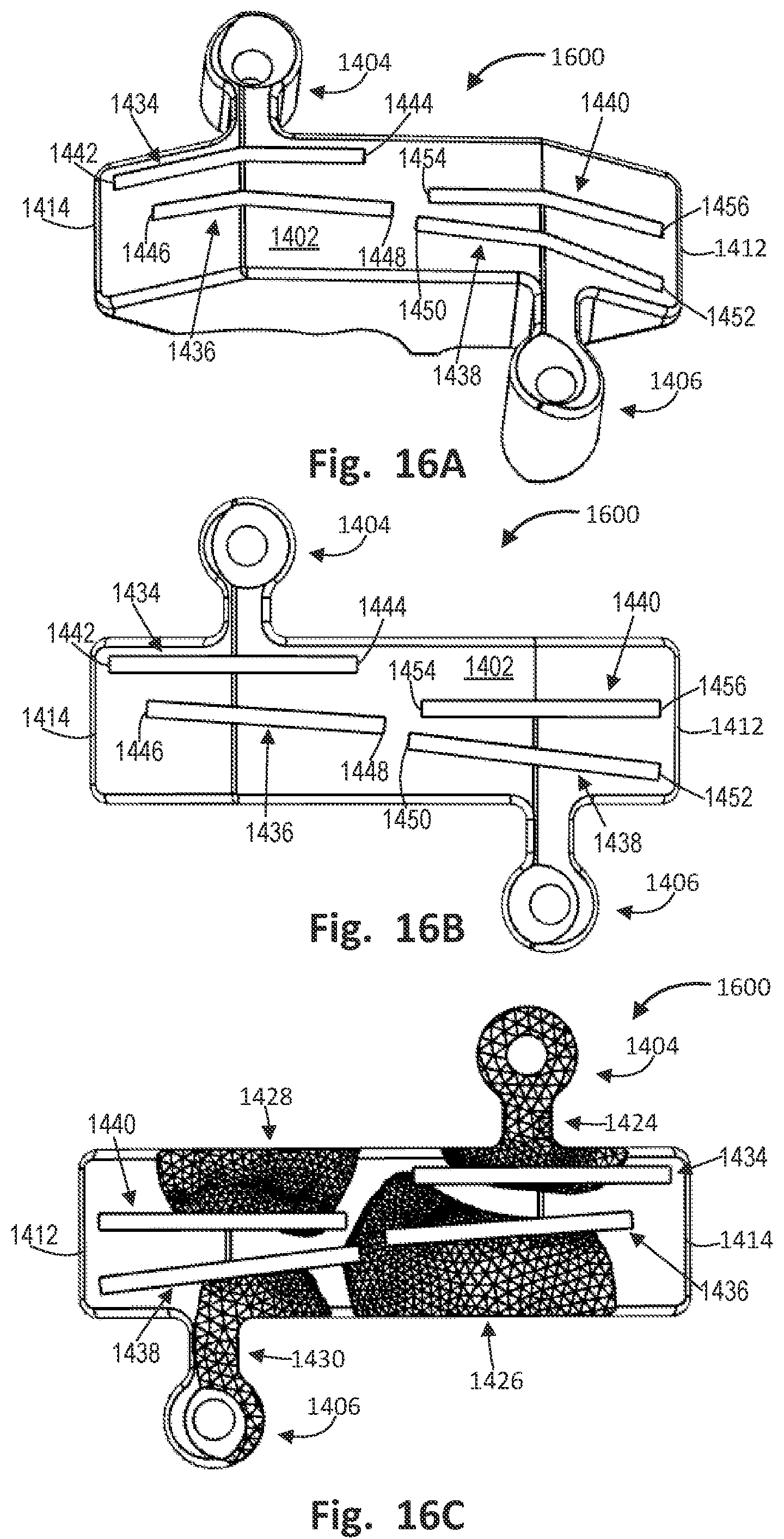 Patent US12496137 Figure 19 – Patient-specific osteotomy instrumentation