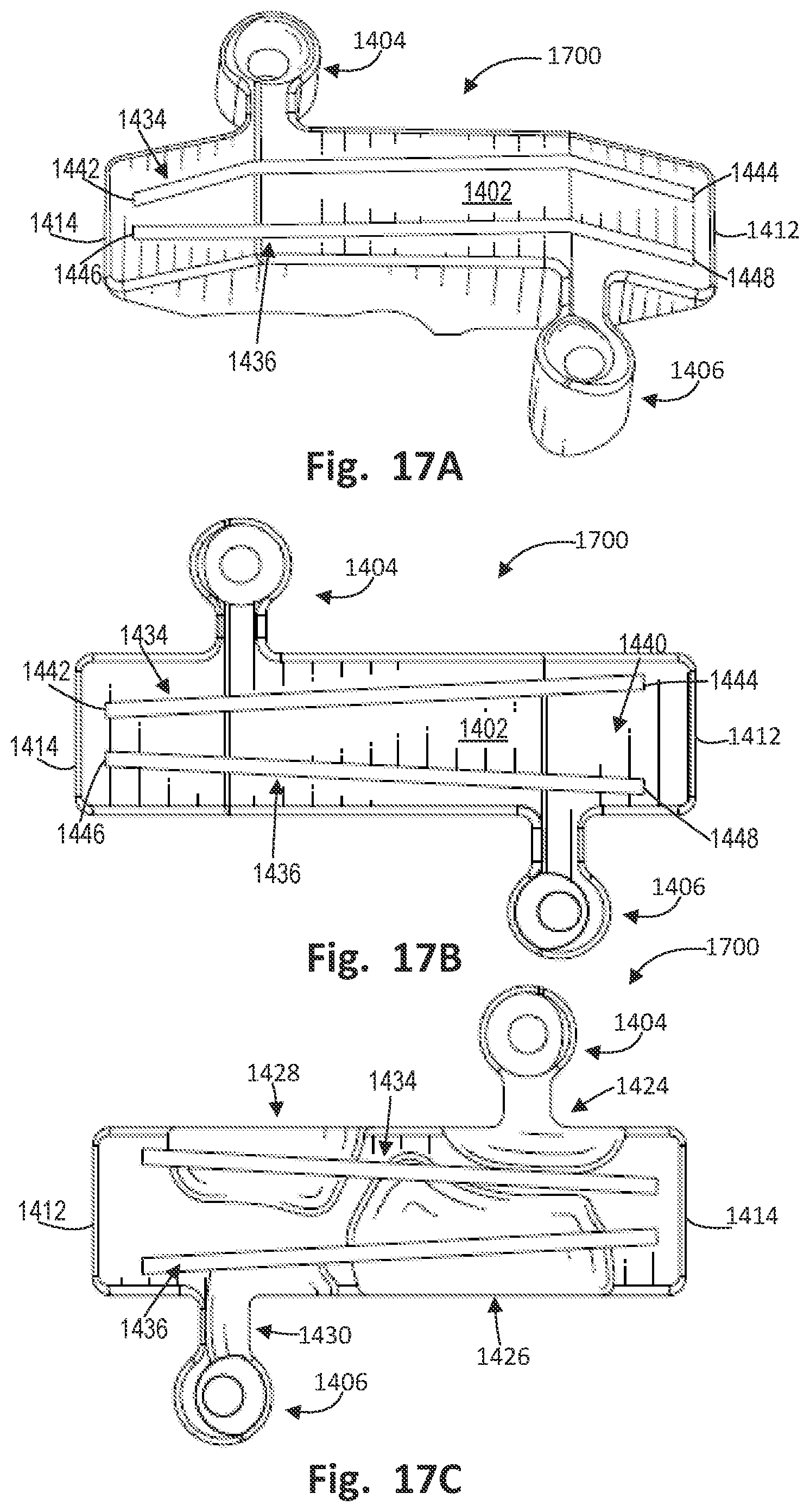 Patent US12496137 Figure 20 – Patient-specific osteotomy instrumentation