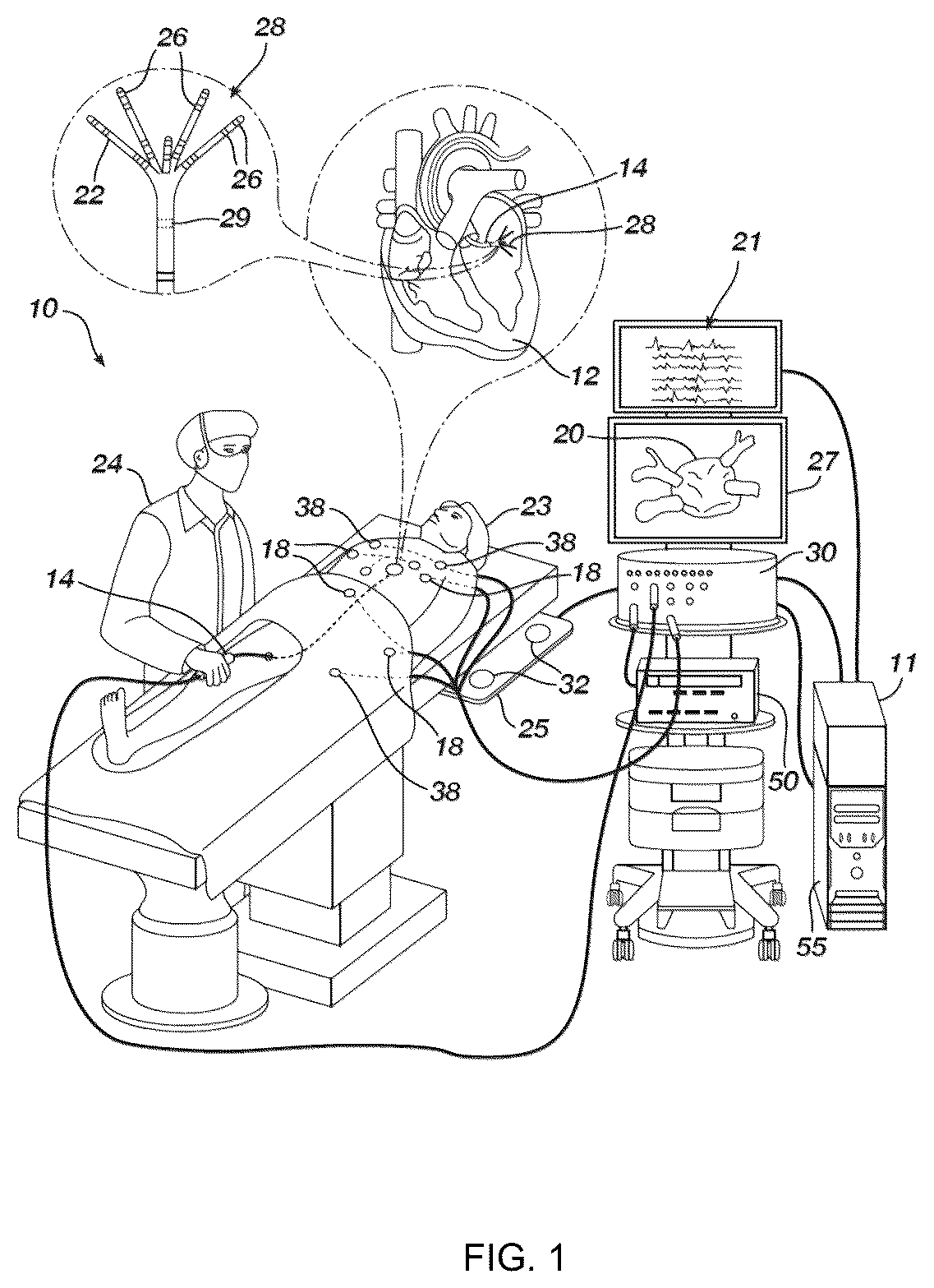 Patent US12496138 Figure 1 – Automated tool for identifying and correcting tenting artifacts in anatomical mapping