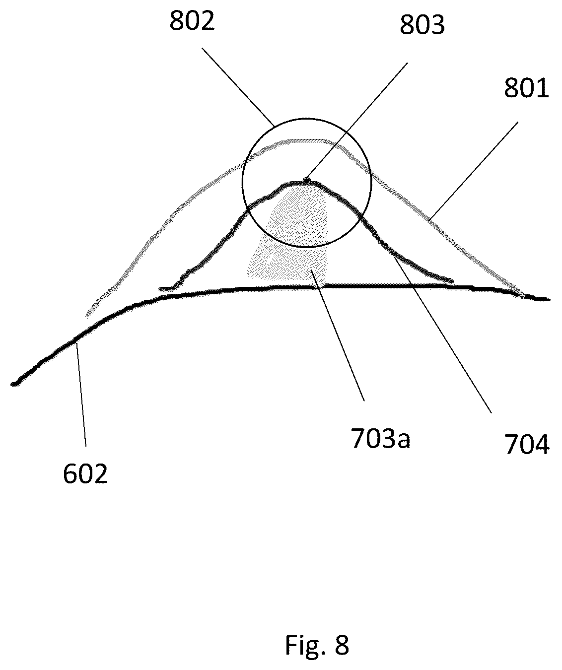 Patent US12496138 Figure 8 – Automated tool for identifying and correcting tenting artifacts in anatomical mapping