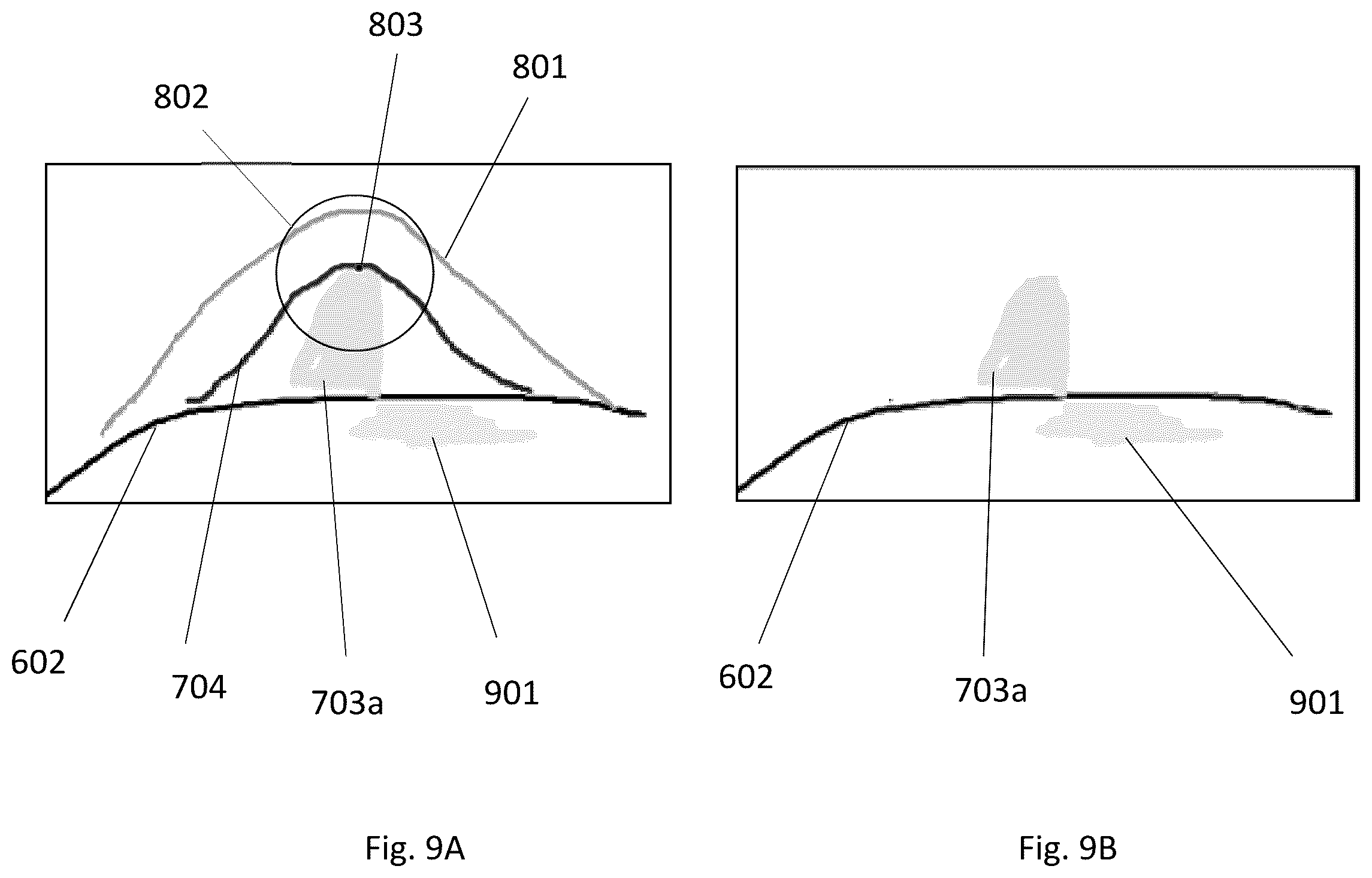 Patent US12496138 Figure 9 – Automated tool for identifying and correcting tenting artifacts in anatomical mapping