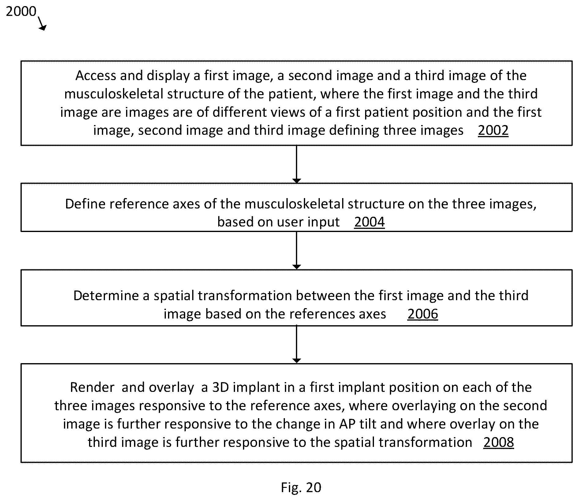 Patent US12496139 Figure 18 – System and method for pre-planning a procedure