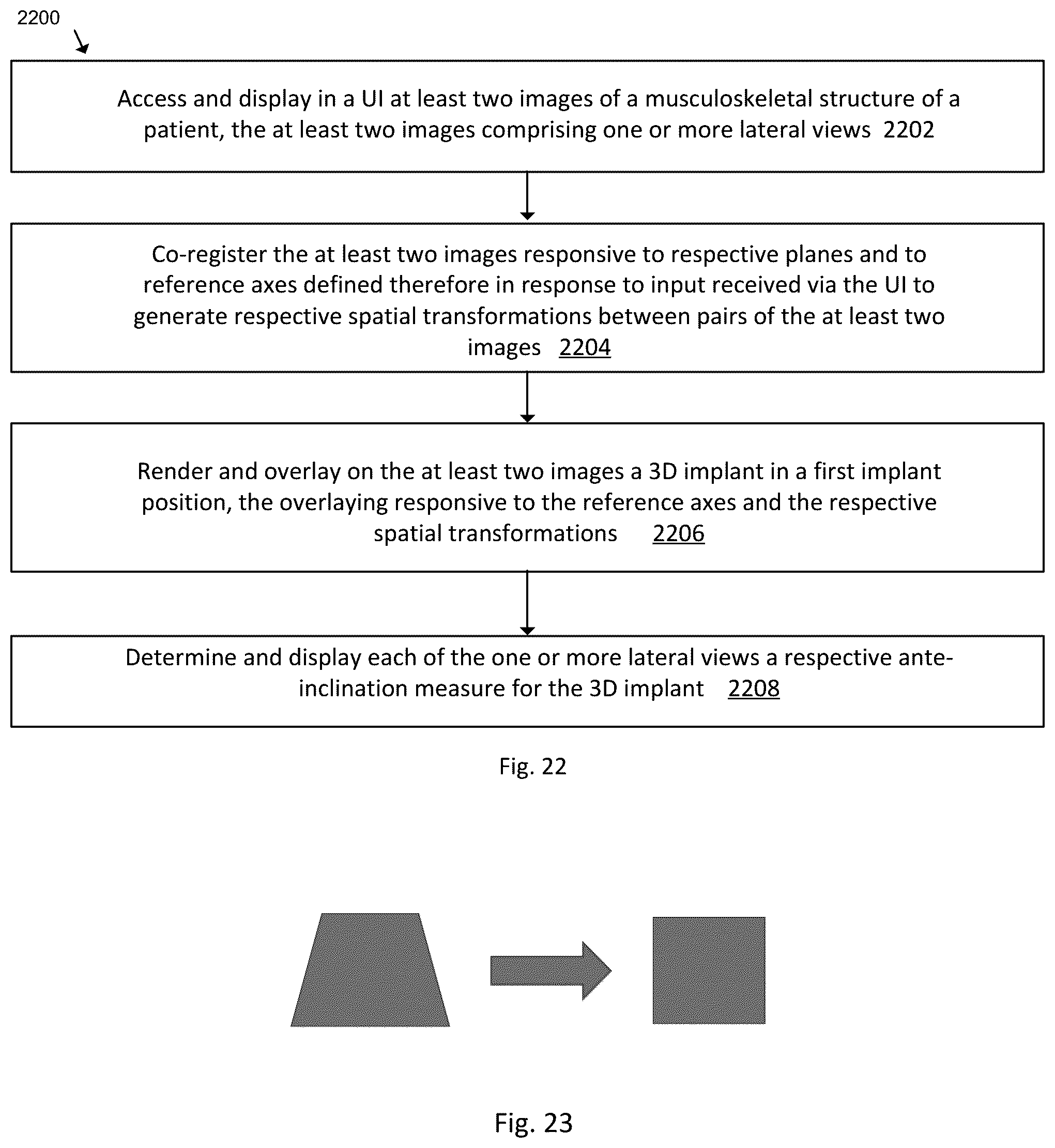 Patent US12496139 Figure 20 – System and method for pre-planning a procedure