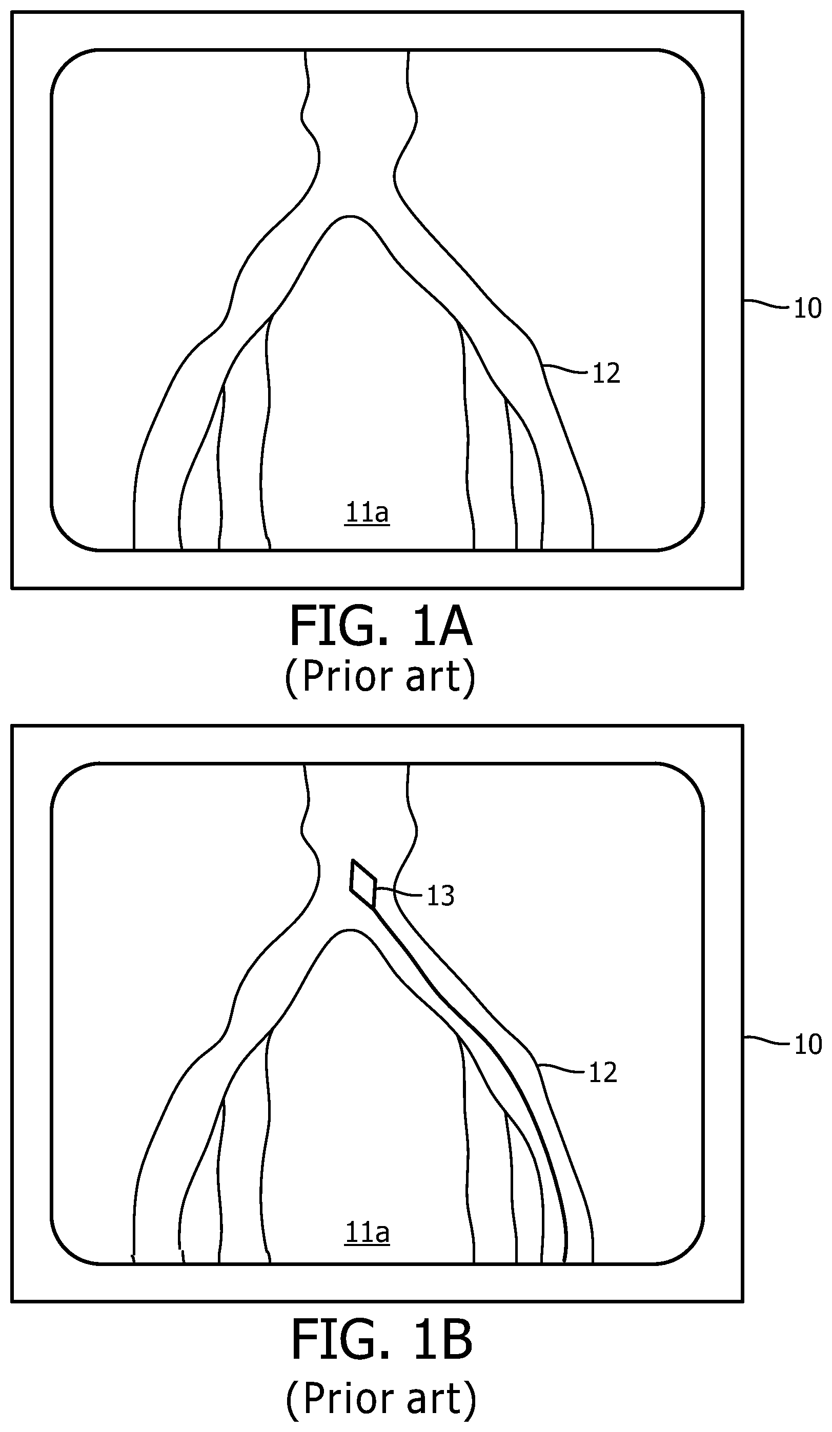 Patent US12496140 Figure 1 – Automatic field of view updating of position tracked interventional device