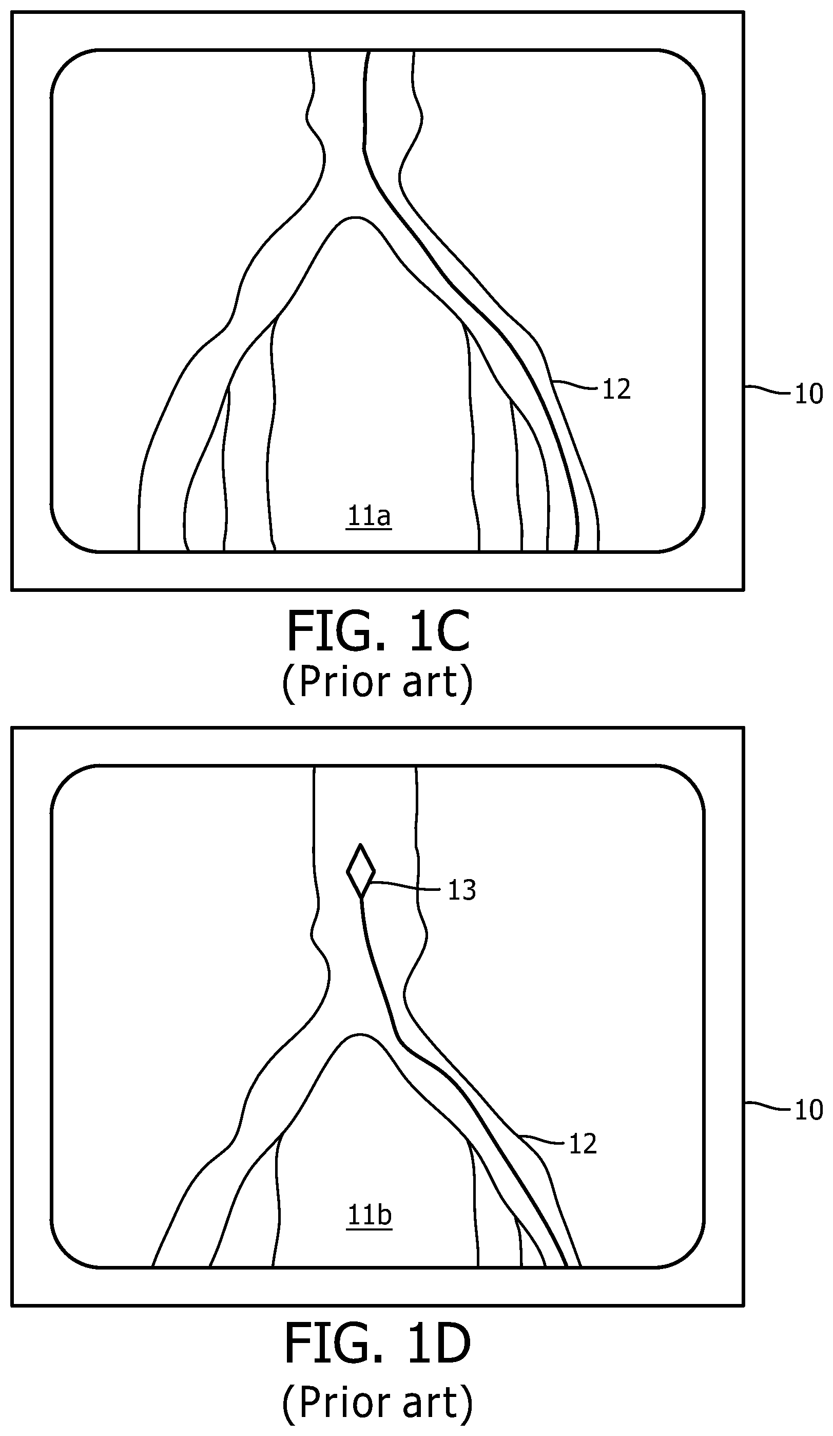 Patent US12496140 Figure 2 – Automatic field of view updating of position tracked interventional device