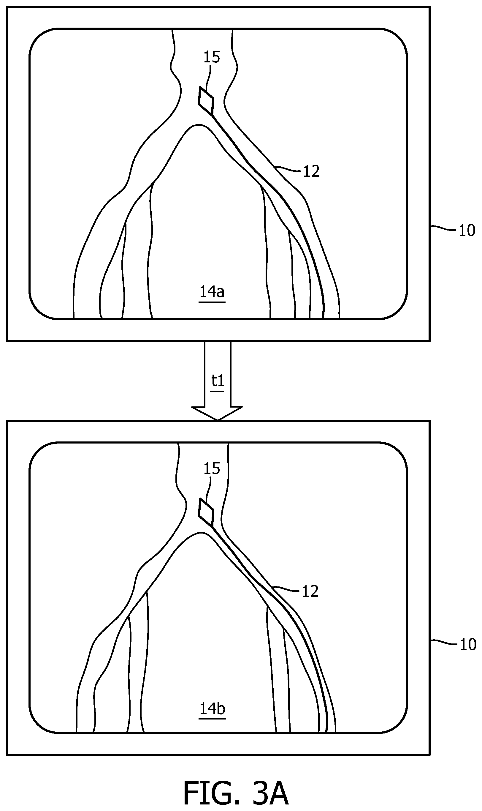 Patent US12496140 Figure 6 – Automatic field of view updating of position tracked interventional device
