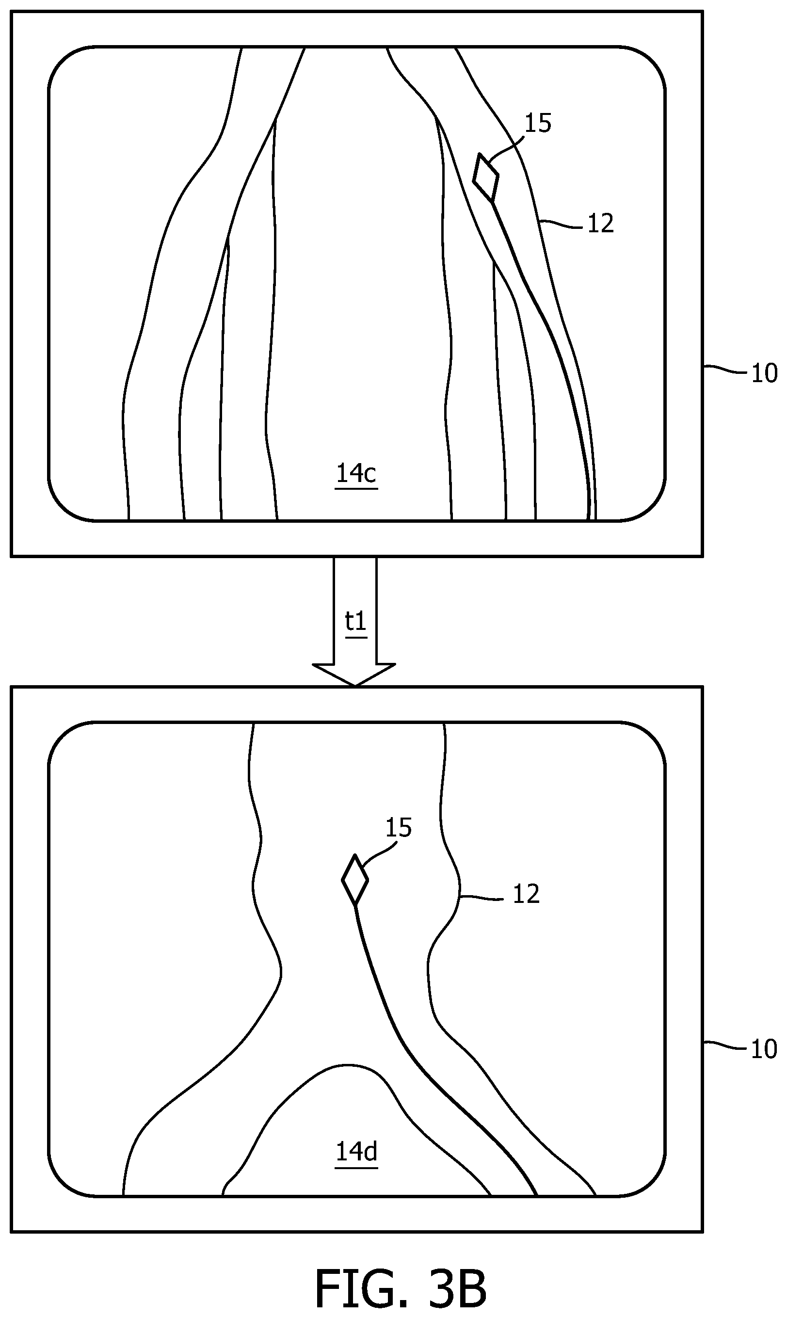 Patent US12496140 Figure 7 – Automatic field of view updating of position tracked interventional device