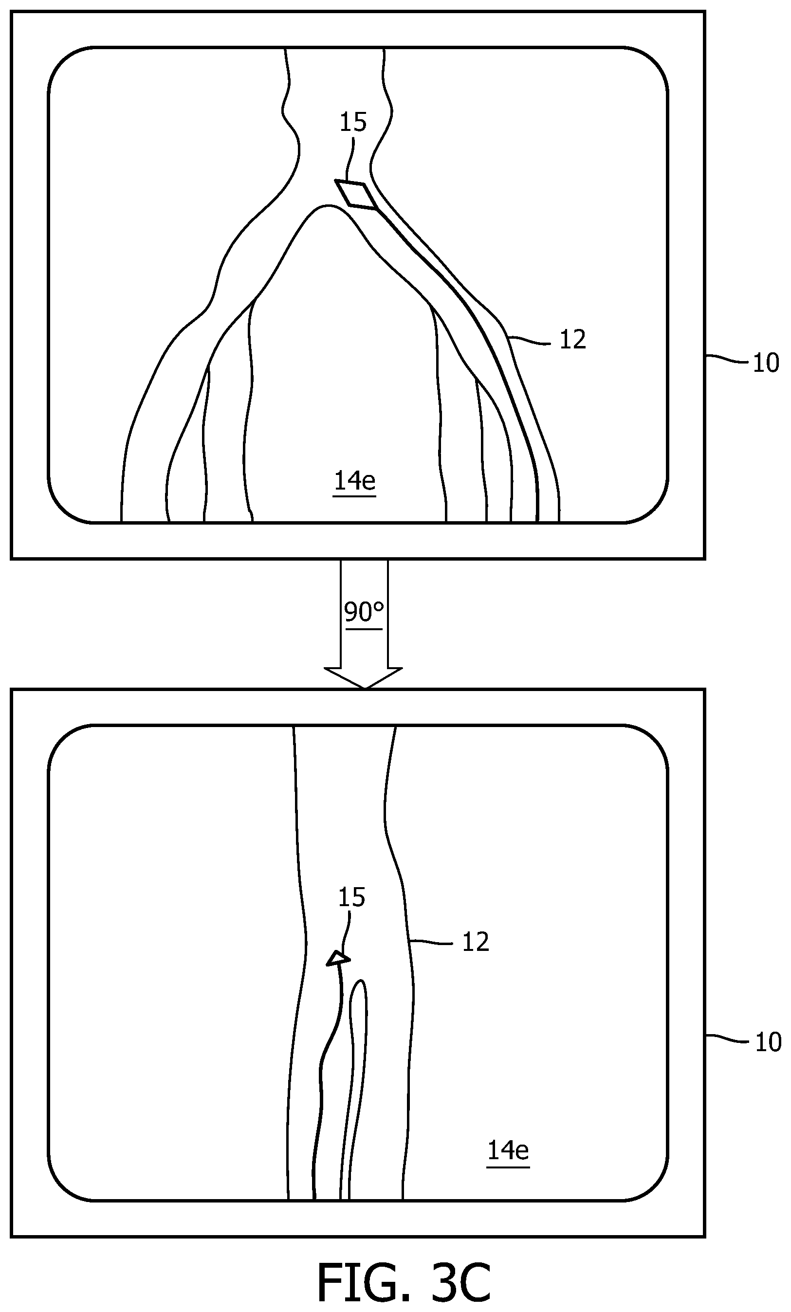 Patent US12496140 Figure 8 – Automatic field of view updating of position tracked interventional device