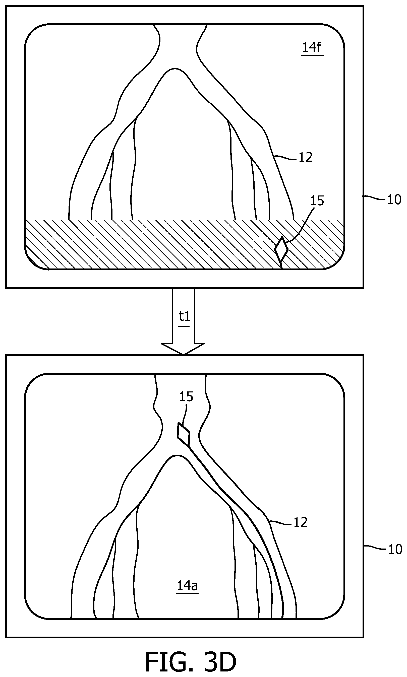 Patent US12496140 Figure 9 – Automatic field of view updating of position tracked interventional device