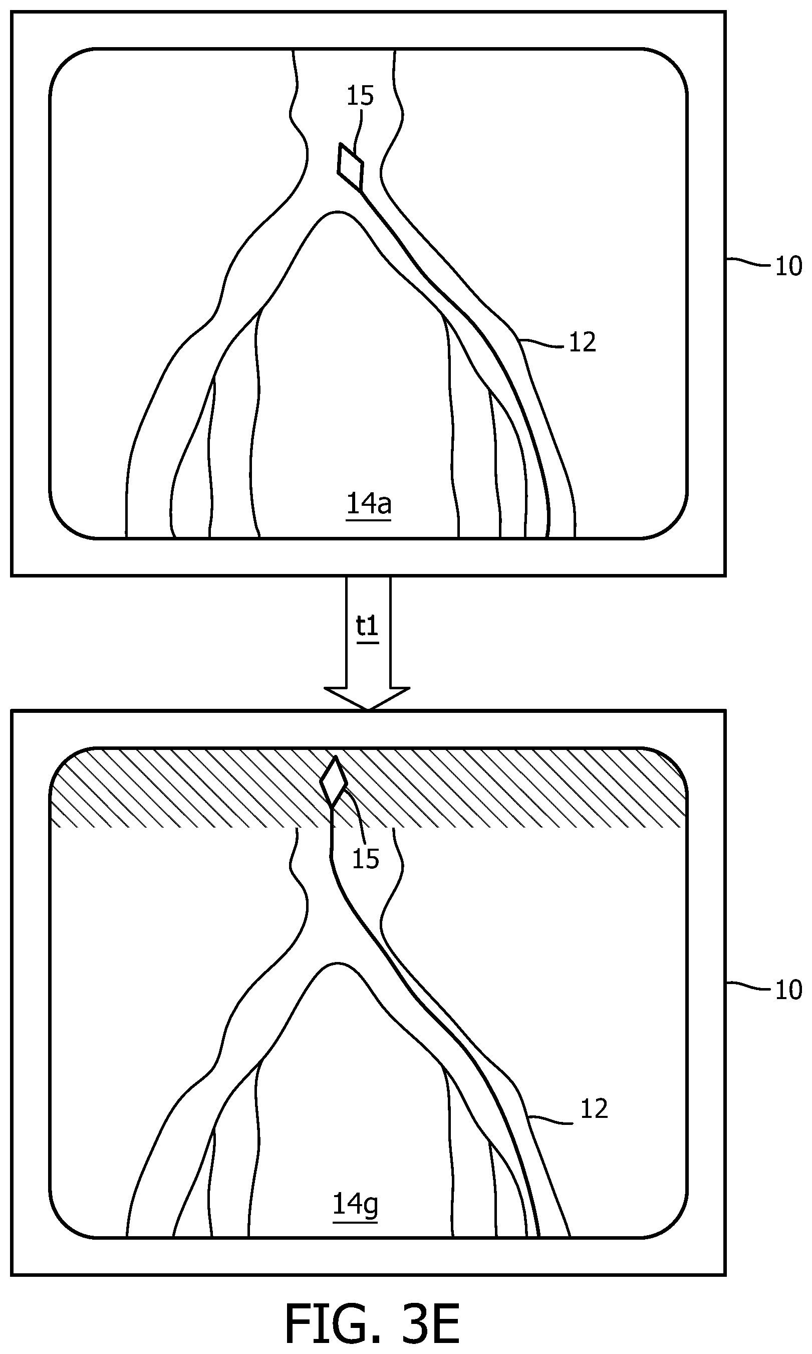 Patent US12496140 Figure 10 – Automatic field of view updating of position tracked interventional device