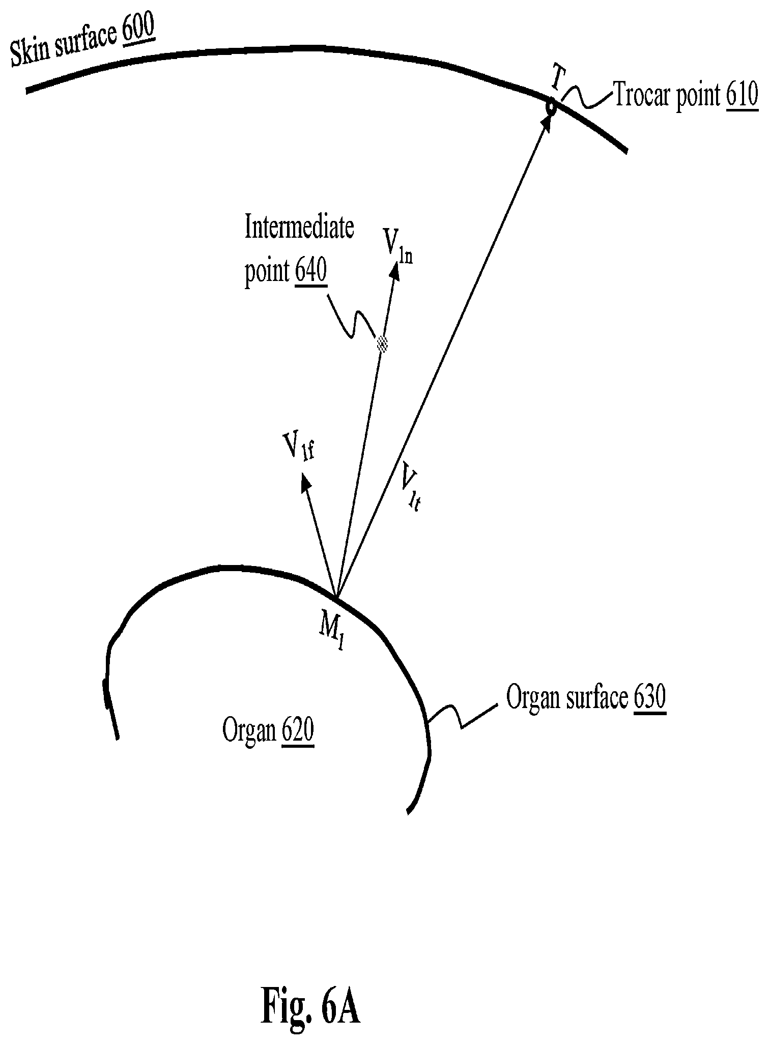 Patent US12496142 Figure 11 – System and method for automated surgical position marking in robot-assisted surgery