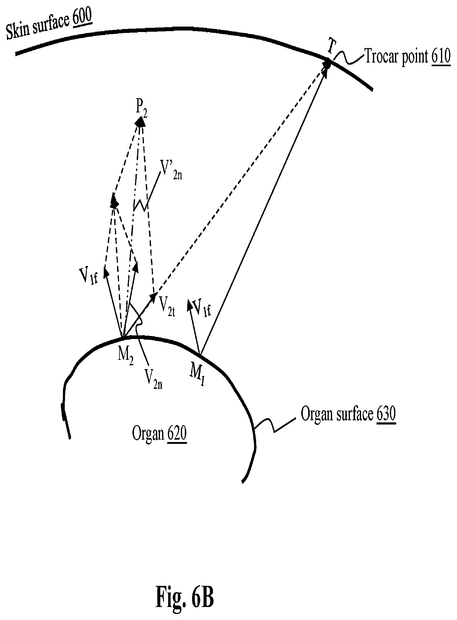 Patent US12496142 Figure 12 – System and method for automated surgical position marking in robot-assisted surgery