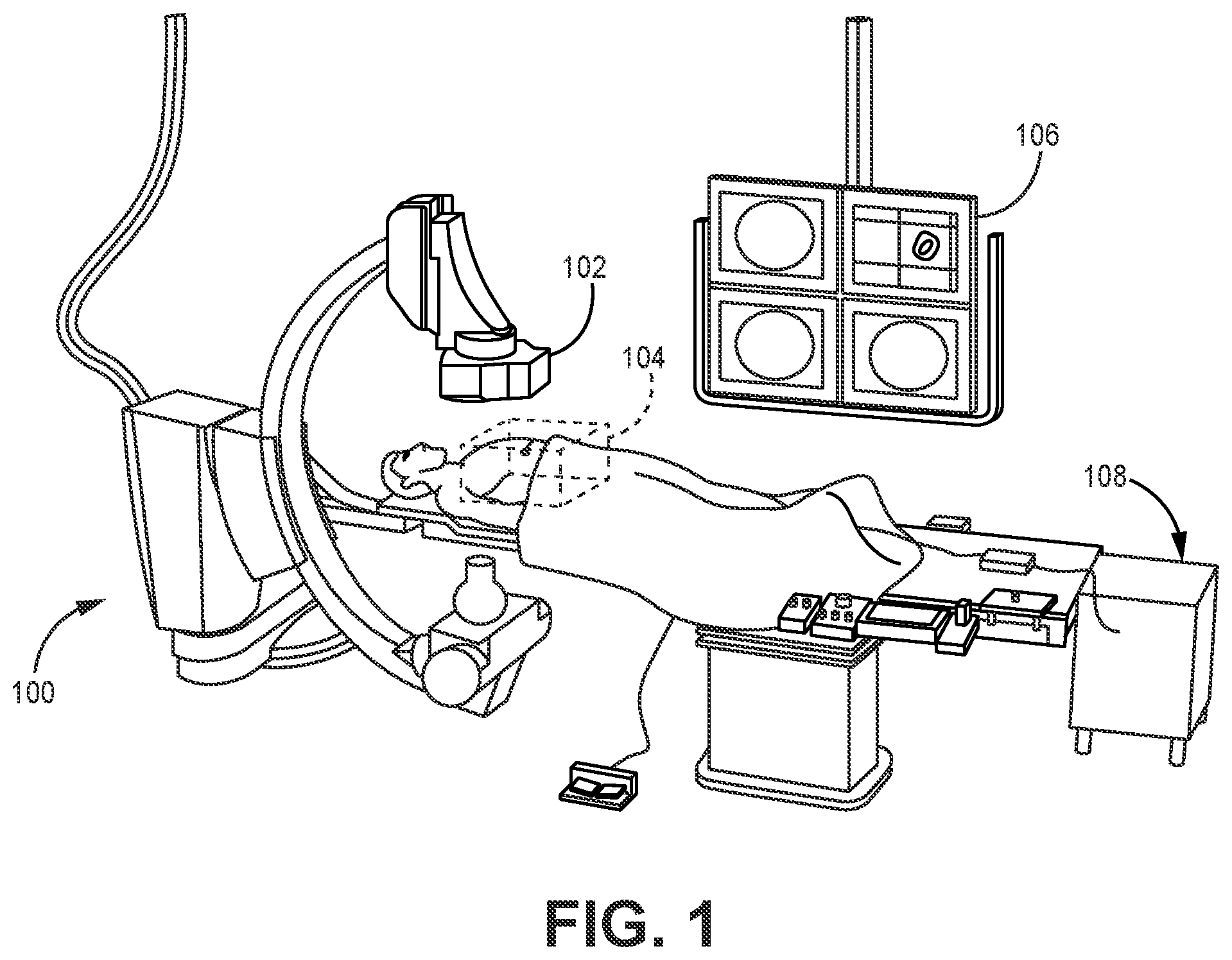 Patent US12496143 Figure 1 – Systems and methods for detecting catheter deliberate motion