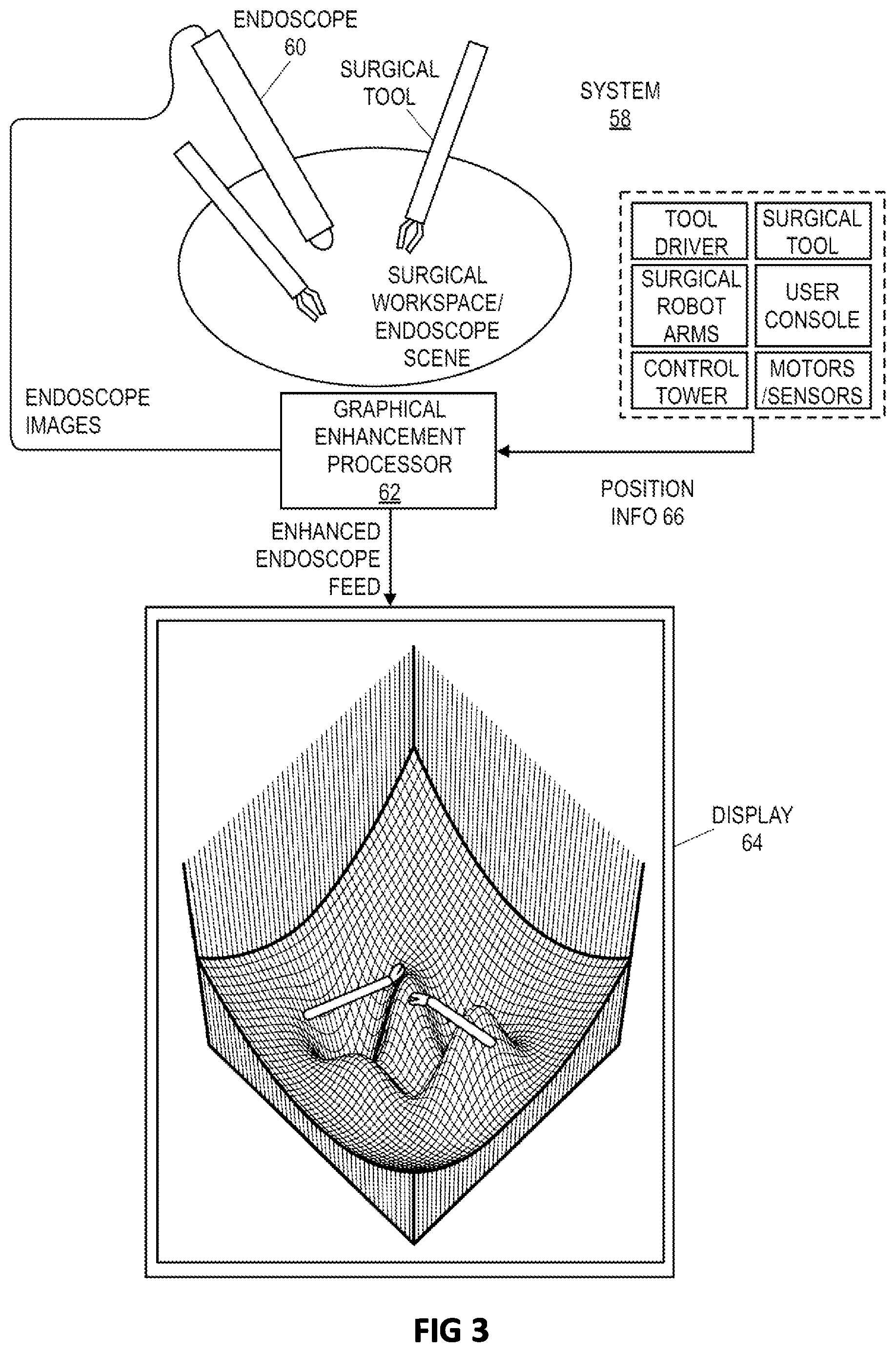 Patent US12496145 Figure 3 – 3D visualization enhancement for depth perception and collision avoidance