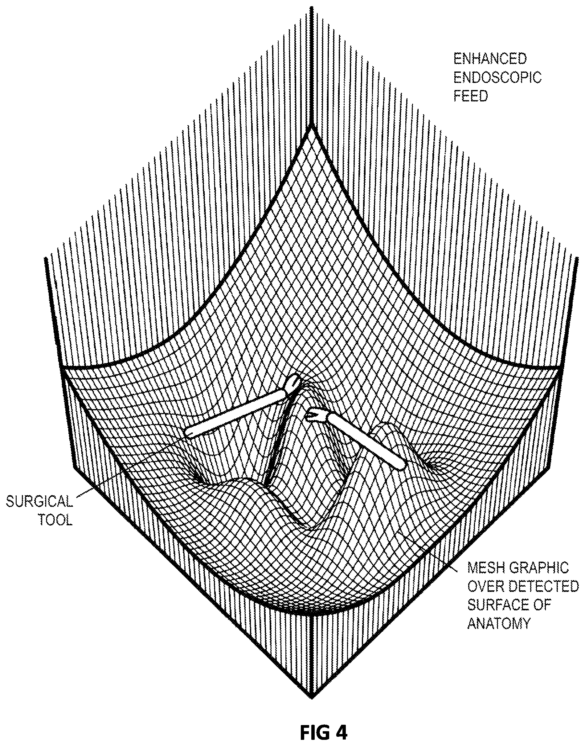 Patent US12496145 Figure 4 – 3D visualization enhancement for depth perception and collision avoidance
