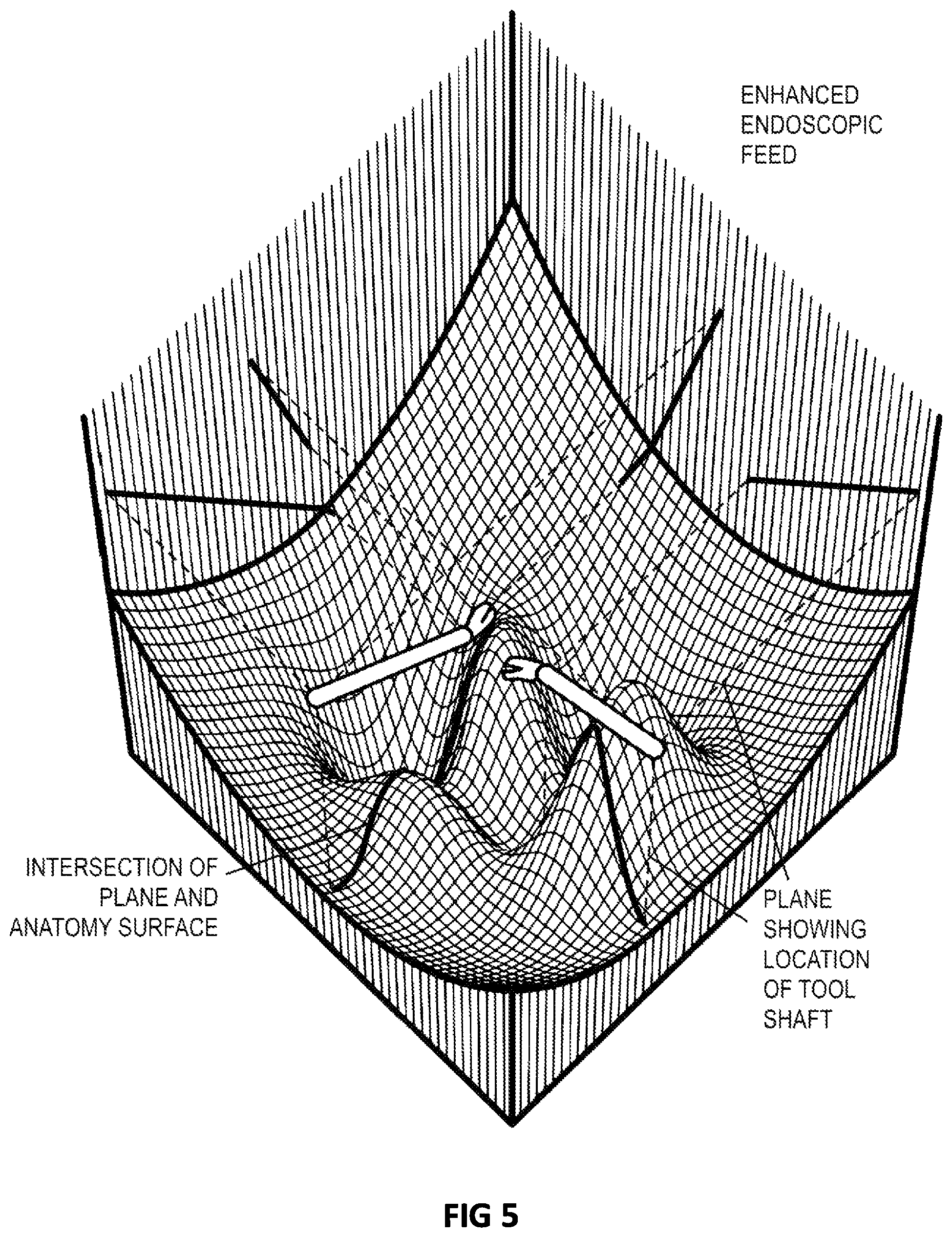 Patent US12496145 Figure 5 – 3D visualization enhancement for depth perception and collision avoidance