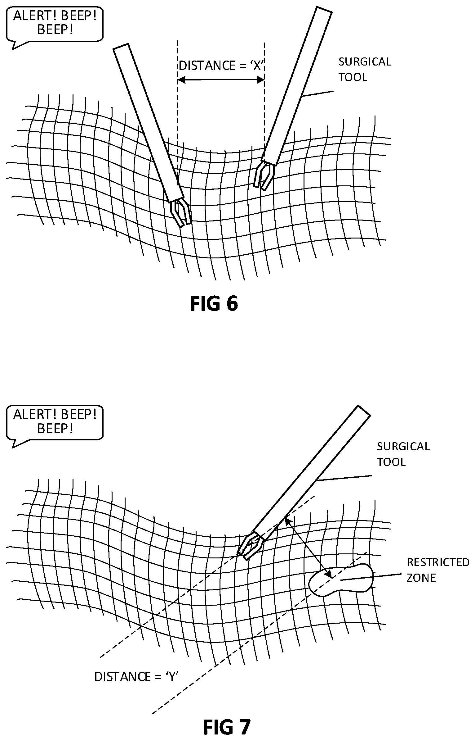 Patent US12496145 Figure 6 – 3D visualization enhancement for depth perception and collision avoidance