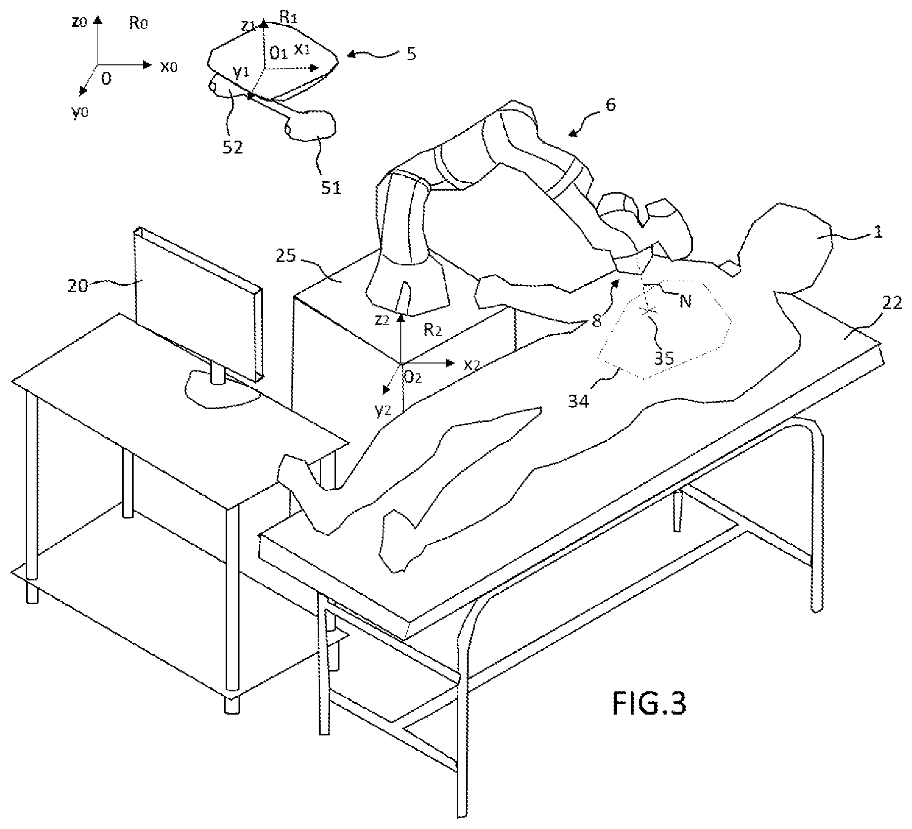 Patent US12496146 Figure 3 – Method for guiding a robot arm, guiding system